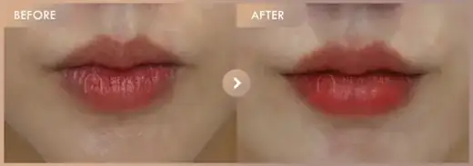 fed3-43f1-8c04-3d0b1837a4b9: before-and-after comparison at Newstar Clinic