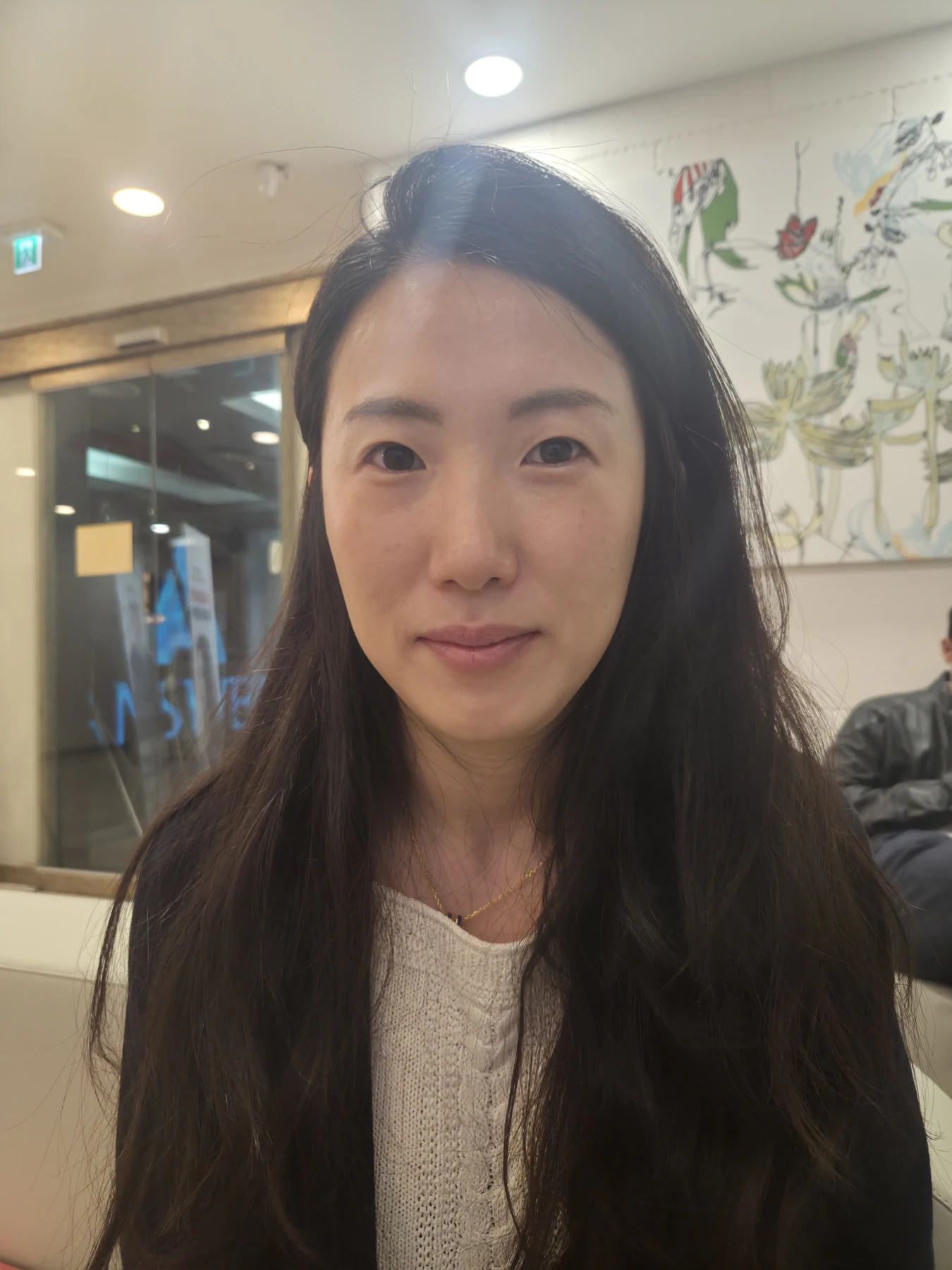 Wonder canthoplasty and under-eye fat repositioning: three-month photo diary · Case 058 at Answer Plastic Surgery. Front view — before, wonder canthoplasty and under-eye fat repositioning at Answer Plastic Surgery (case 058).