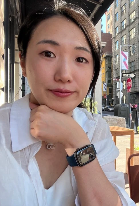 Wonder canthoplasty and under-eye fat repositioning: three-month photo diary · Case 058 at Answer Plastic Surgery. Casual portrait — 3 months, wonder canthoplasty and under-eye fat repositioning at Answer Plastic Surgery (case 058).