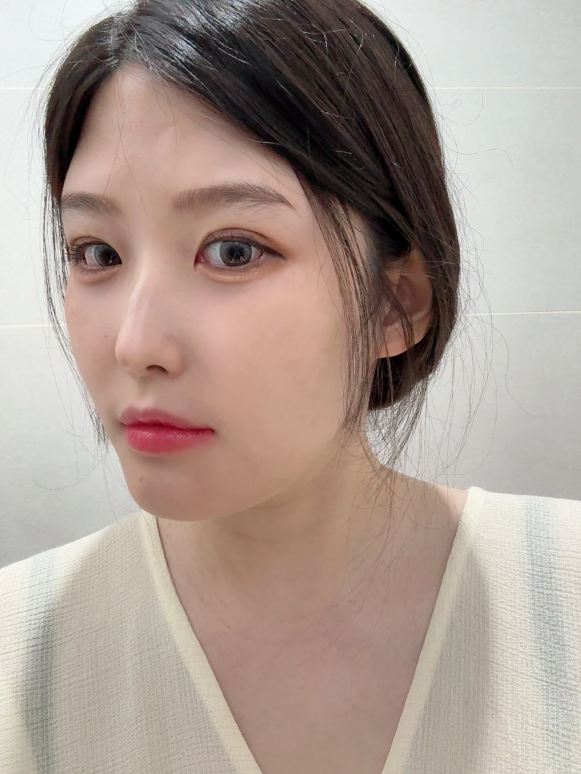 Revision Wonder canthoplasty with lower-corner release: one-month follow-up · Case 060 at Answer Plastic Surgery. Angled view — 1 month, revision wonder canthoplasty with lower-corner release at Answer Plastic Surgery (case 060).