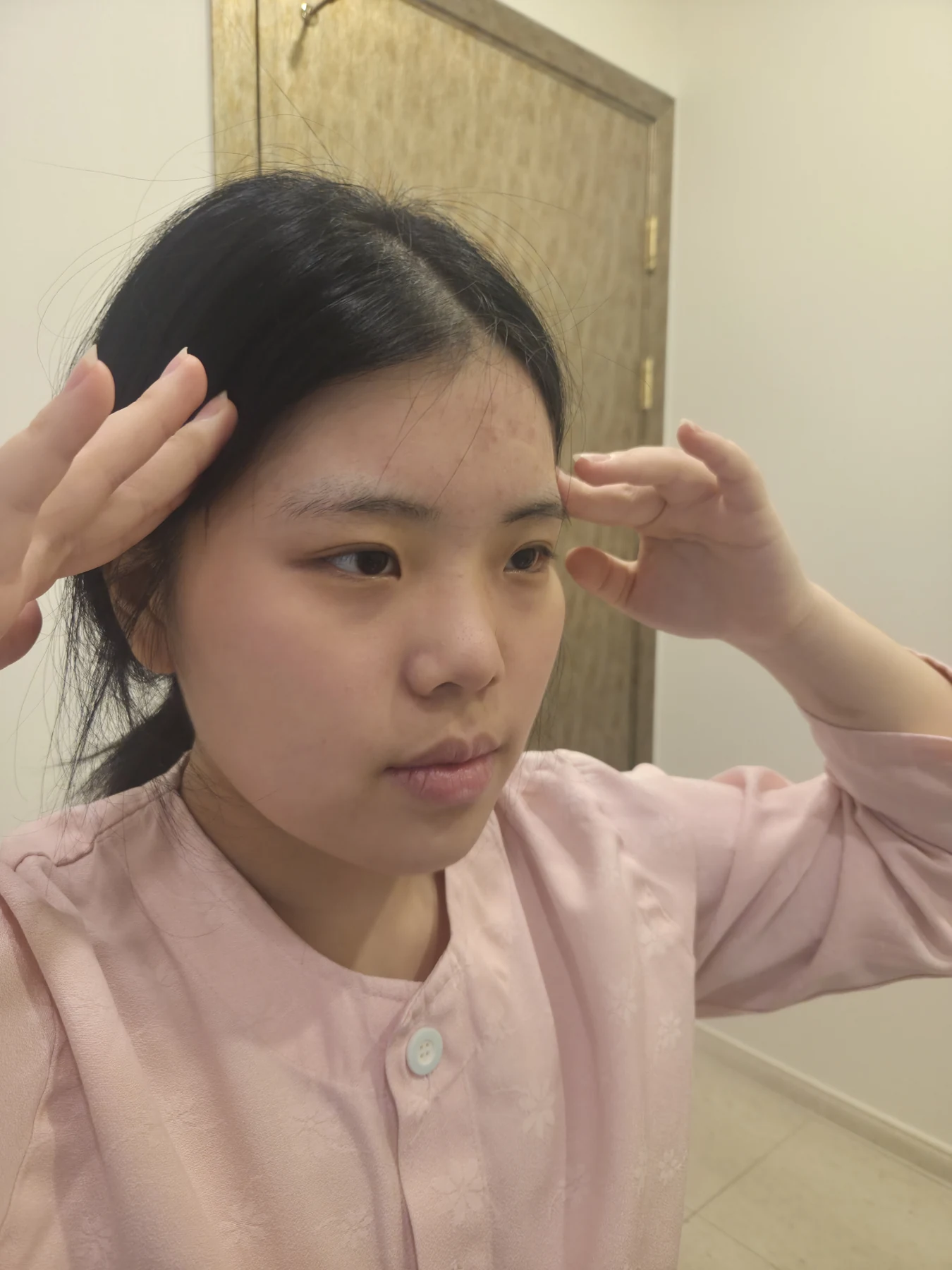 Eye-area surgery: before and two-month follow-up · Case 062 at Answer Plastic Surgery. Three-quarter view — before, eye-area surgery at Answer Plastic Surgery (case 062).