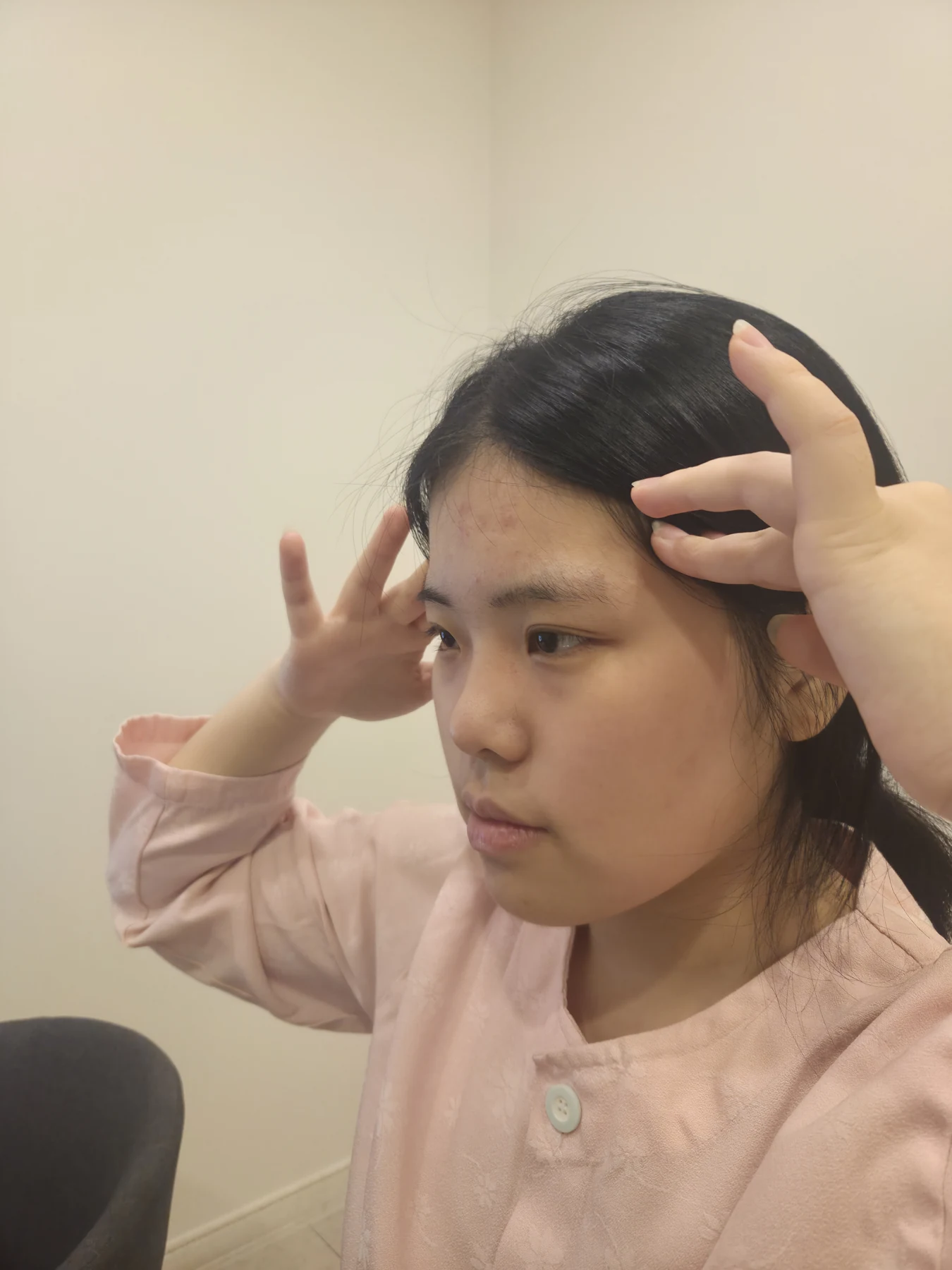 Eye-area surgery: before and two-month follow-up · Case 062 at Answer Plastic Surgery. Opposite three-quarter view — before, eye-area surgery at Answer Plastic Surgery (case 062).