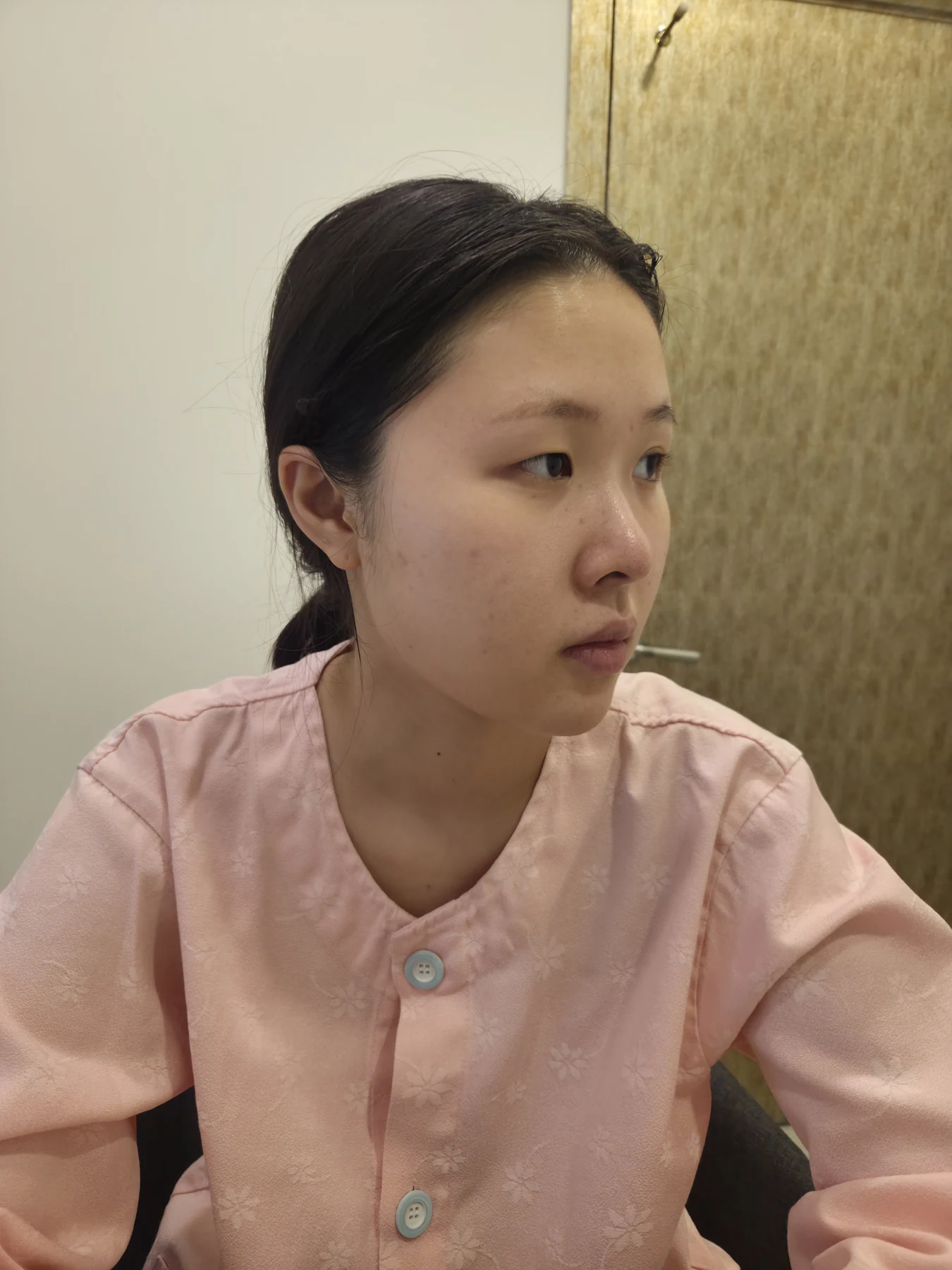 Wonder canthoplasty and eye-area surgery: six-month photo record · Case 063 at Answer Plastic Surgery. Three-quarter view — before, wonder canthoplasty and eye-area surgery at Answer Plastic Surgery (case 063).