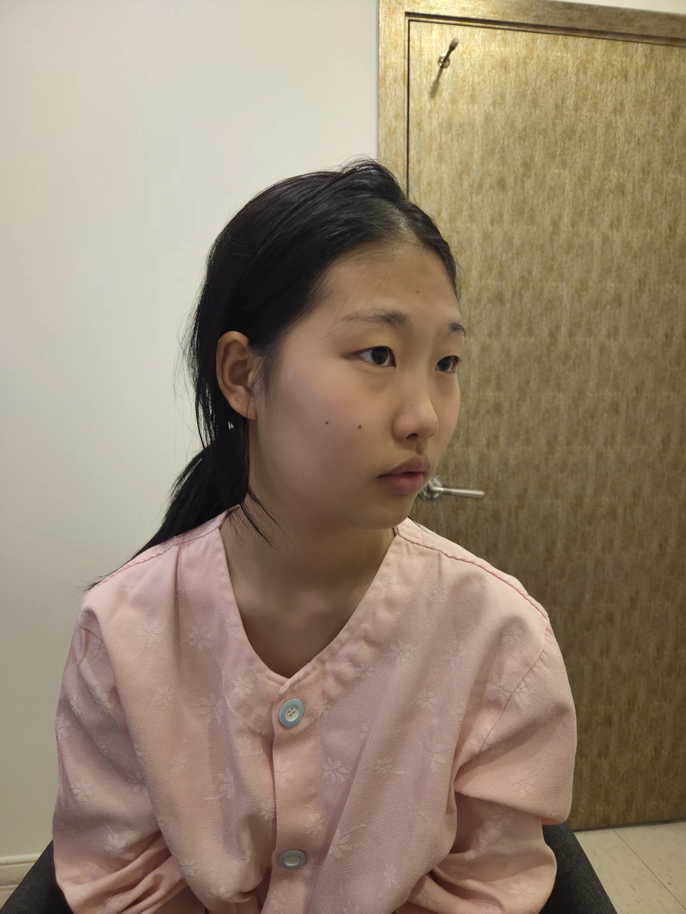 Eye-area comparison: before, treatment day and one month · Case 064 at Answer Plastic Surgery. Opposite three-quarter view — before, eye-area comparison at Answer Plastic Surgery (case 064).