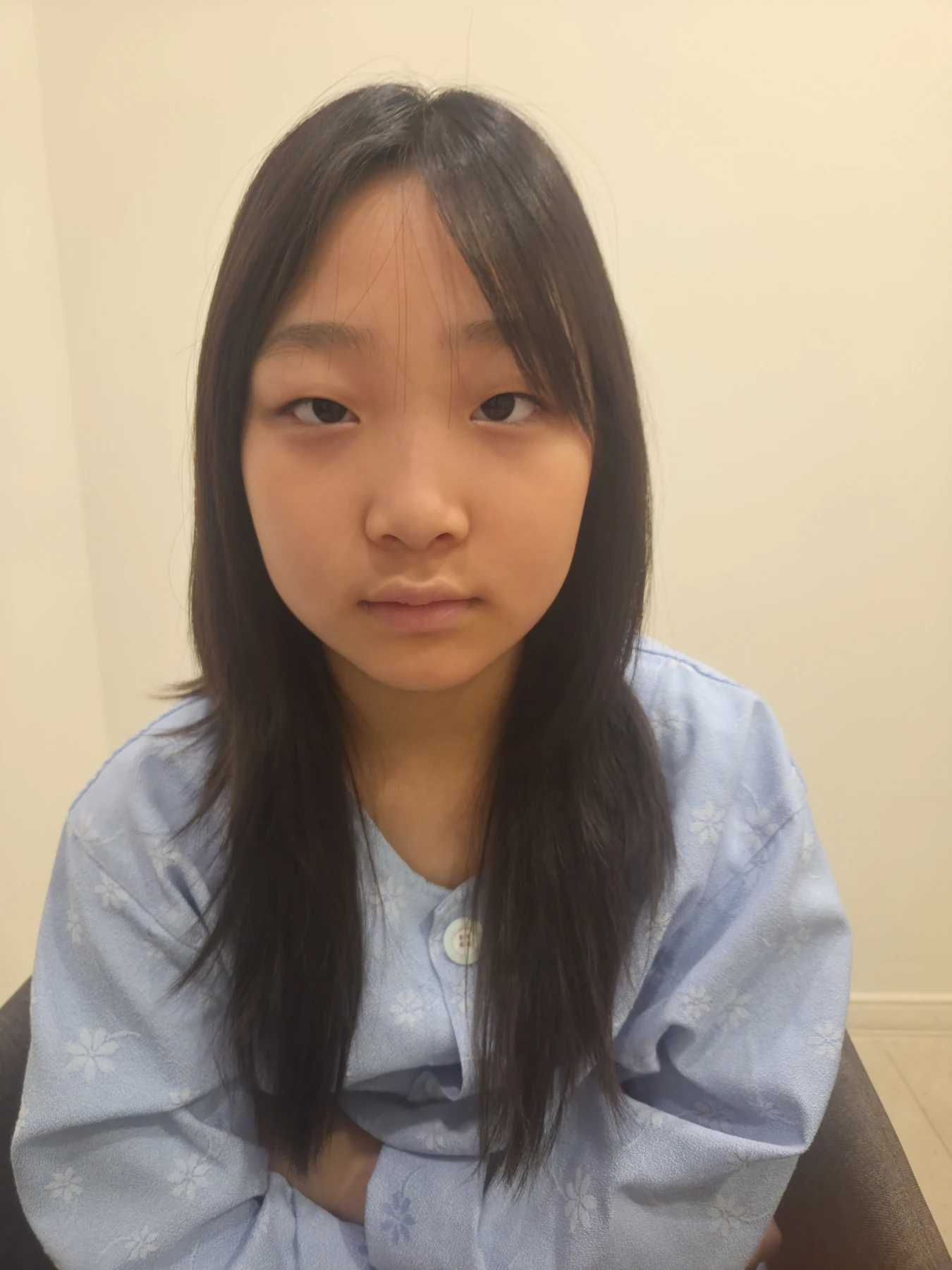 Eye-area surgery: a month of follow-up photographs · Case 065 at Answer Plastic Surgery. Front view — before, eye-area surgery at Answer Plastic Surgery (case 065).