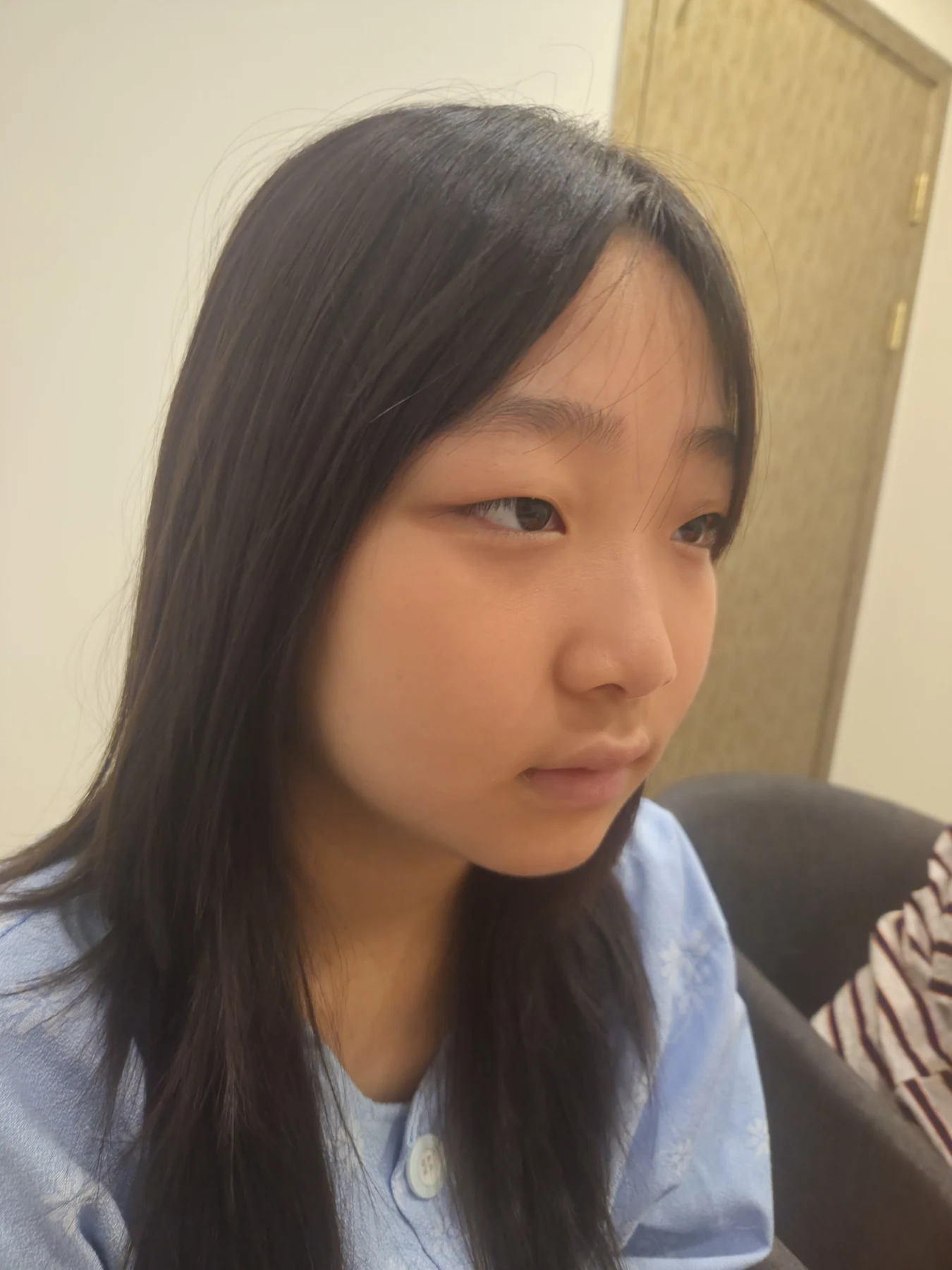 Eye-area surgery: a month of follow-up photographs · Case 065 at Answer Plastic Surgery. Three-quarter view — before, eye-area surgery at Answer Plastic Surgery (case 065).