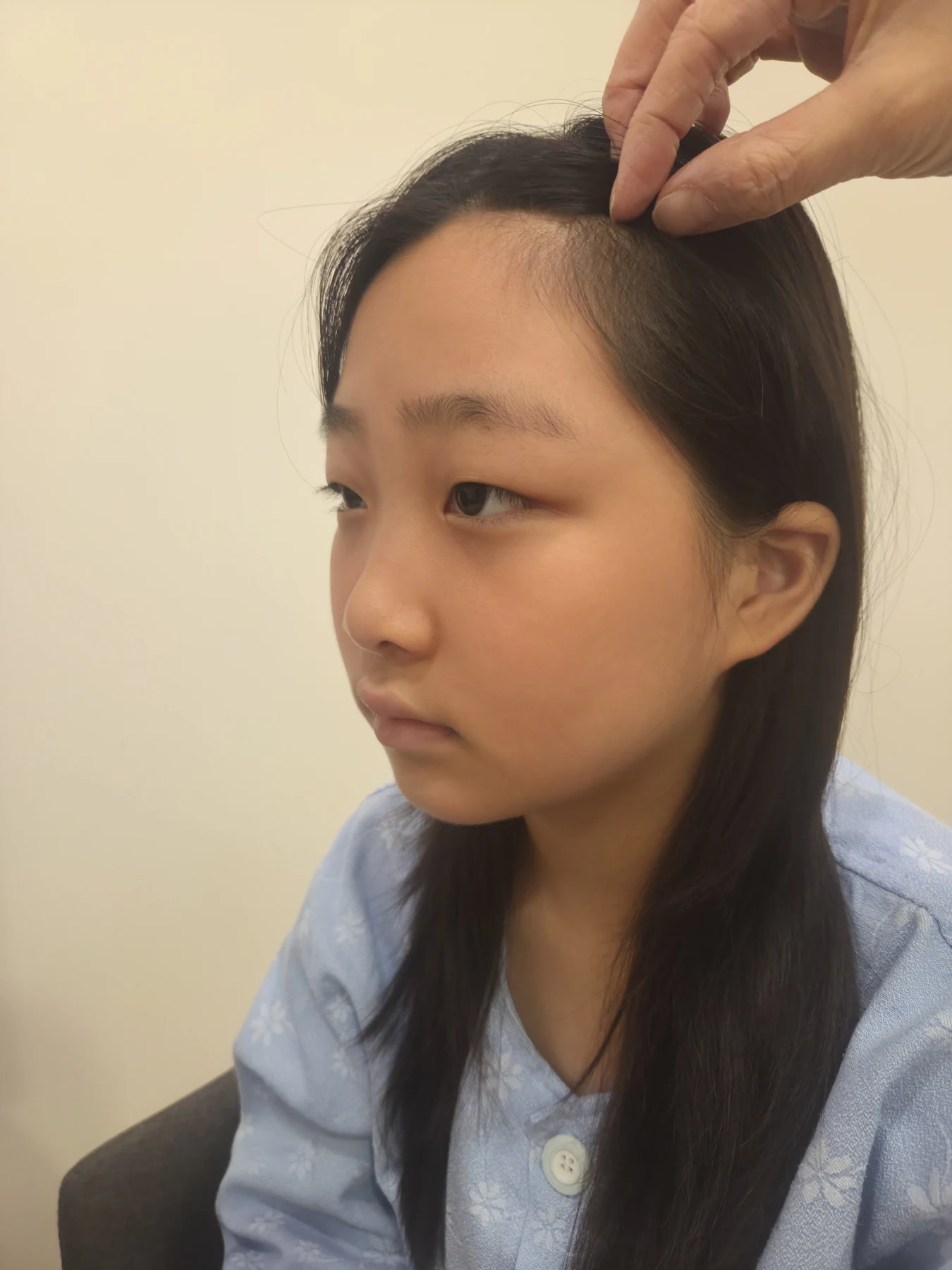 Eye-area surgery: a month of follow-up photographs · Case 065 at Answer Plastic Surgery. Opposite three-quarter view — before, eye-area surgery at Answer Plastic Surgery (case 065).