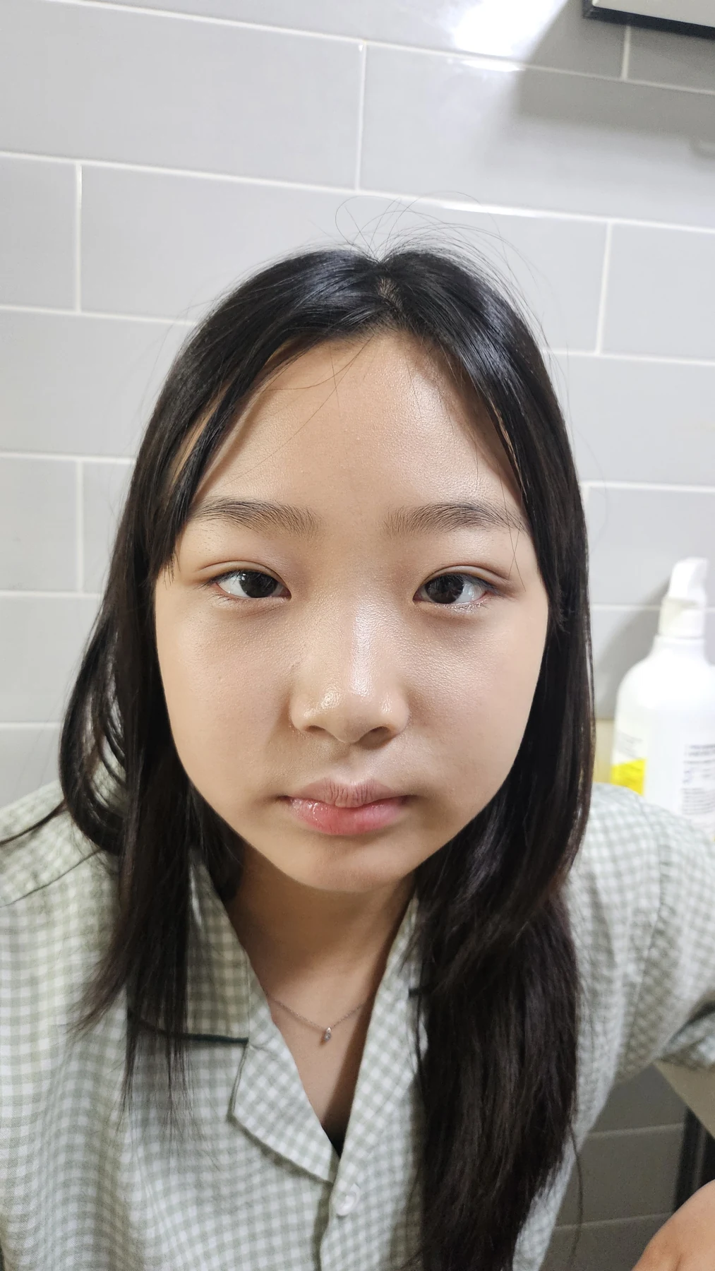 Eye-area surgery: a month of follow-up photographs · Case 065 at Answer Plastic Surgery. Front view — 2 weeks, eye-area surgery at Answer Plastic Surgery (case 065).