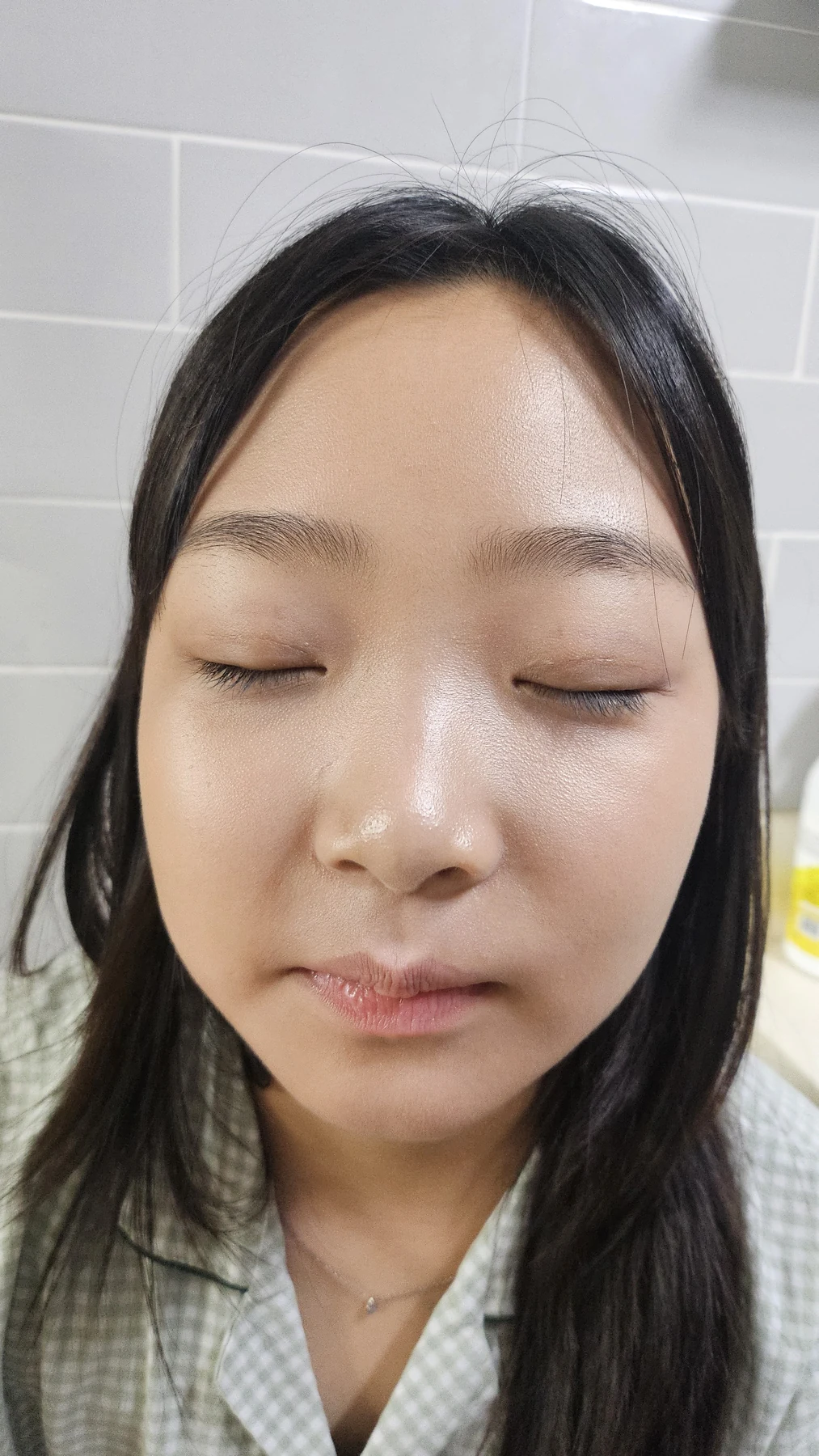 Eye-area surgery: a month of follow-up photographs · Case 065 at Answer Plastic Surgery. Eyes closed — 2 weeks, eye-area surgery at Answer Plastic Surgery (case 065).