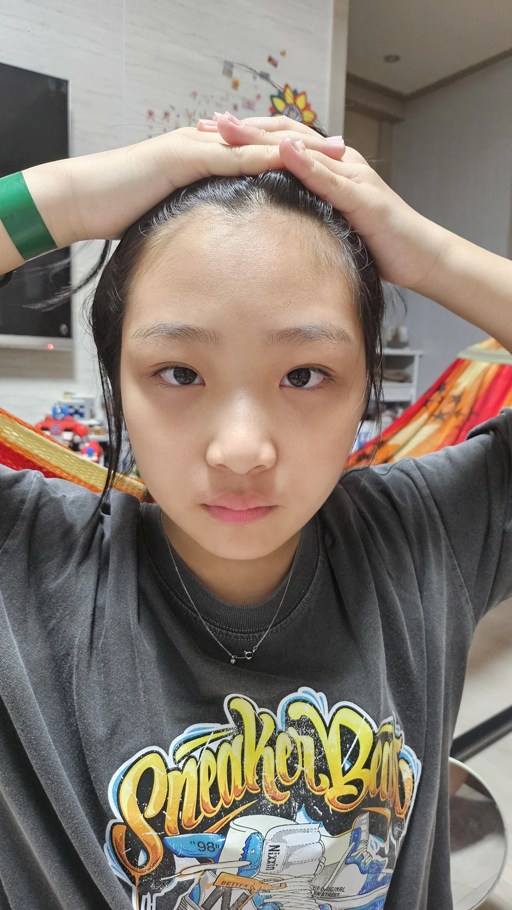 Eye-area surgery: a month of follow-up photographs · Case 065 at Answer Plastic Surgery. Front view — 3 weeks, eye-area surgery at Answer Plastic Surgery (case 065).