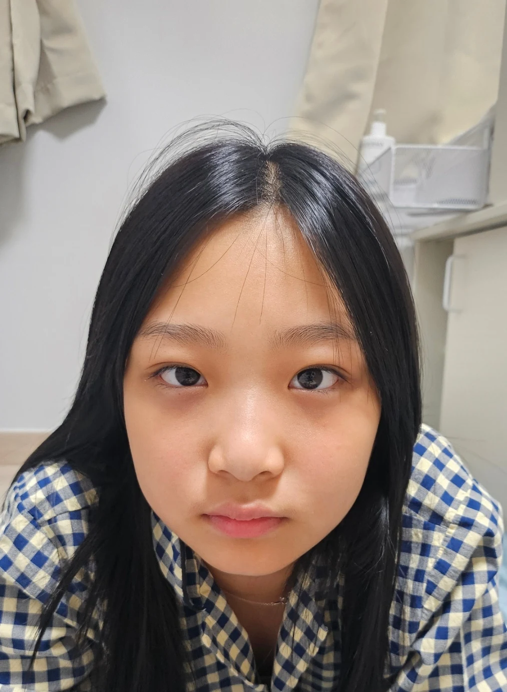 Eye-area surgery: a month of follow-up photographs · Case 065 at Answer Plastic Surgery. Front view — 1 month, eye-area surgery at Answer Plastic Surgery (case 065).