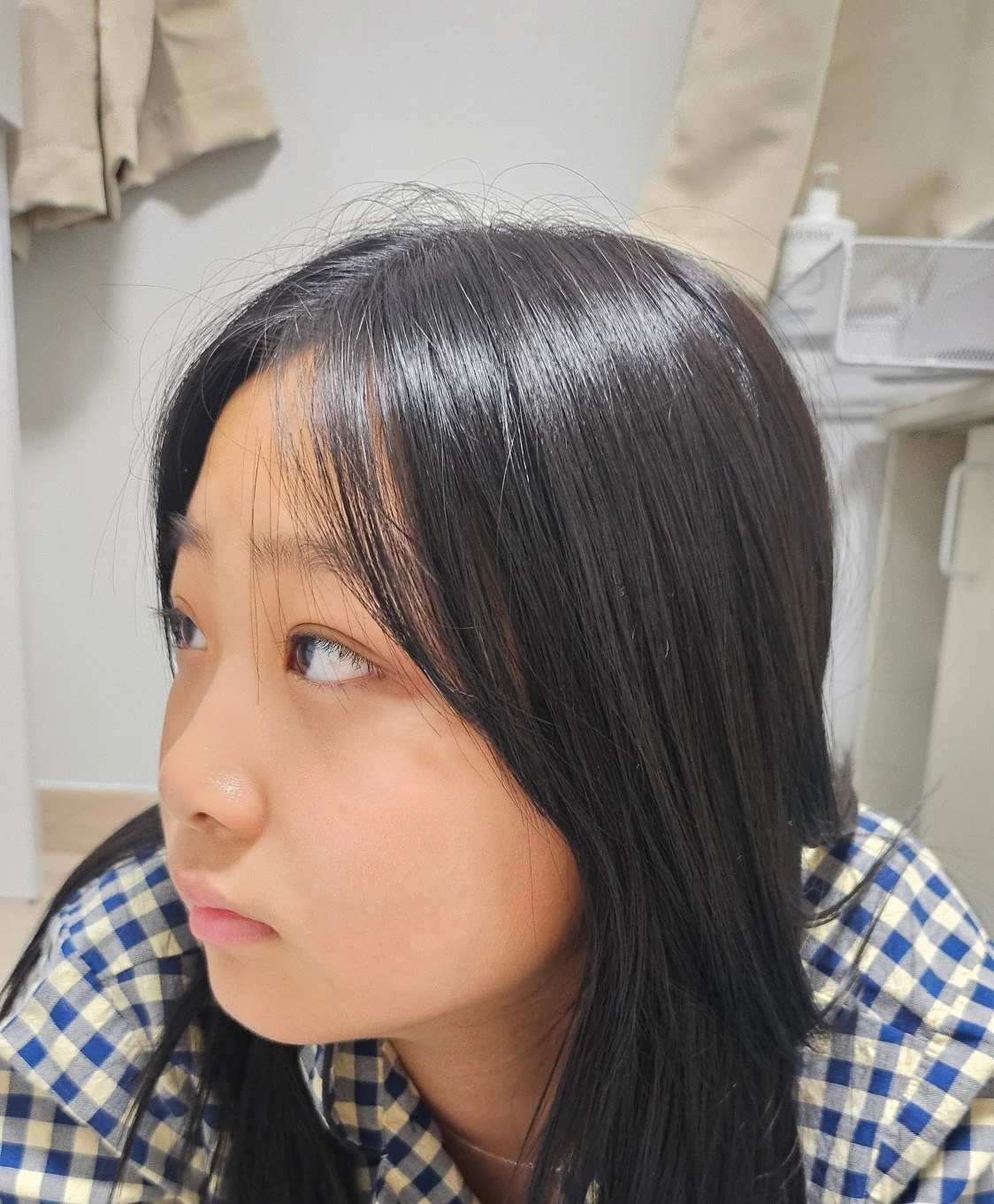 Eye-area surgery: a month of follow-up photographs · Case 065 at Answer Plastic Surgery. Three-quarter view — 1 month, eye-area surgery at Answer Plastic Surgery (case 065).