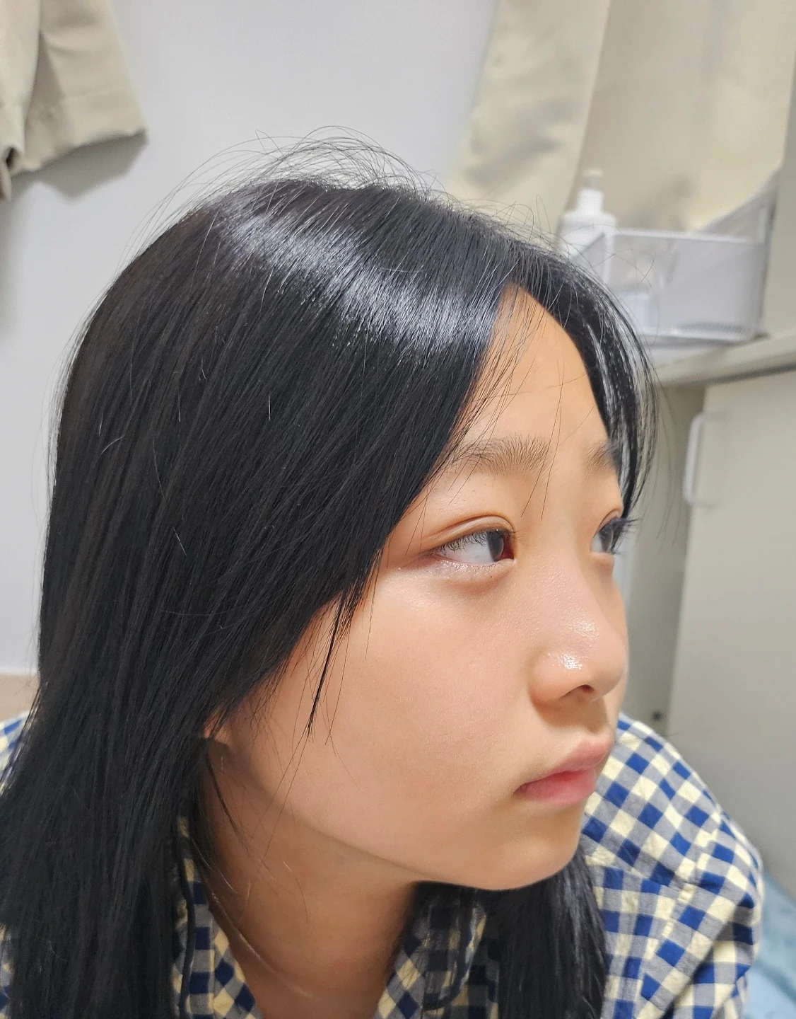 Eye-area surgery: a month of follow-up photographs · Case 065 at Answer Plastic Surgery. Opposite three-quarter view — 1 month, eye-area surgery at Answer Plastic Surgery (case 065).