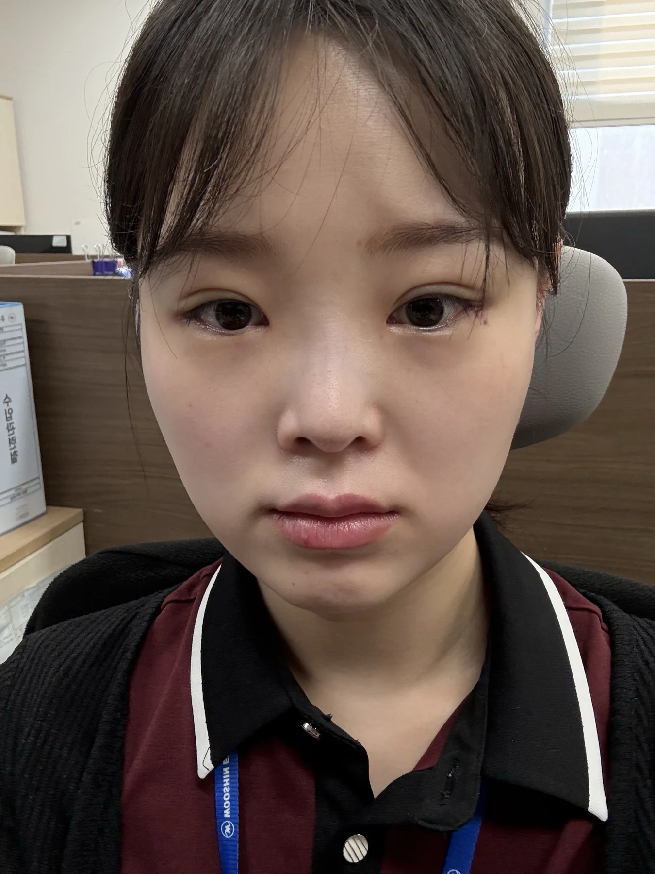 Eyelid and inner-corner surgery: six-month photo diary · Case 066 at Answer Plastic Surgery. Front view — 3 weeks, eyelid and inner-corner surgery at Answer Plastic Surgery (case 066).