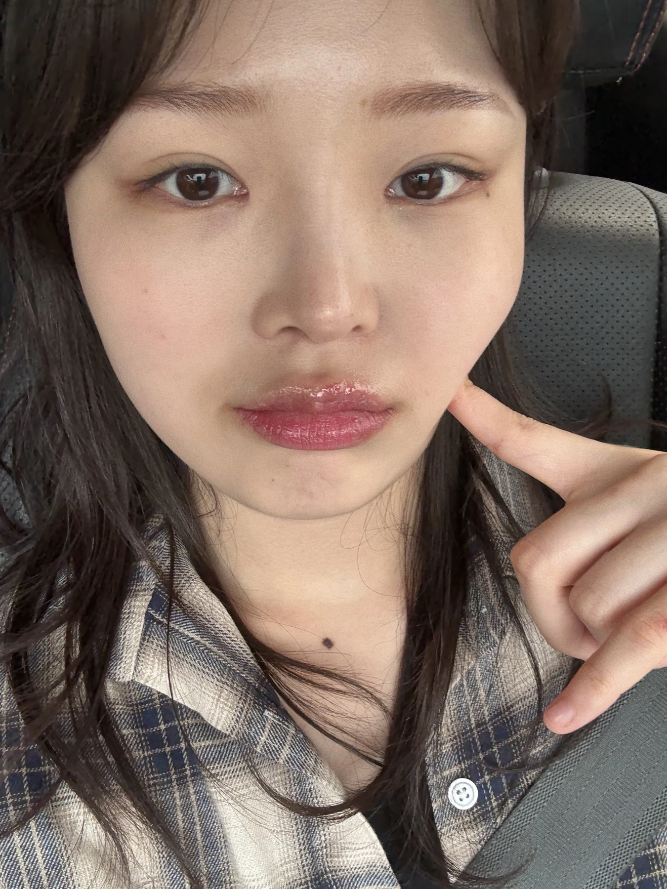 Eyelid and inner-corner surgery: six-month photo diary · Case 066 at Answer Plastic Surgery. Front-facing selfie — 2 months, eyelid and inner-corner surgery at Answer Plastic Surgery (case 066).