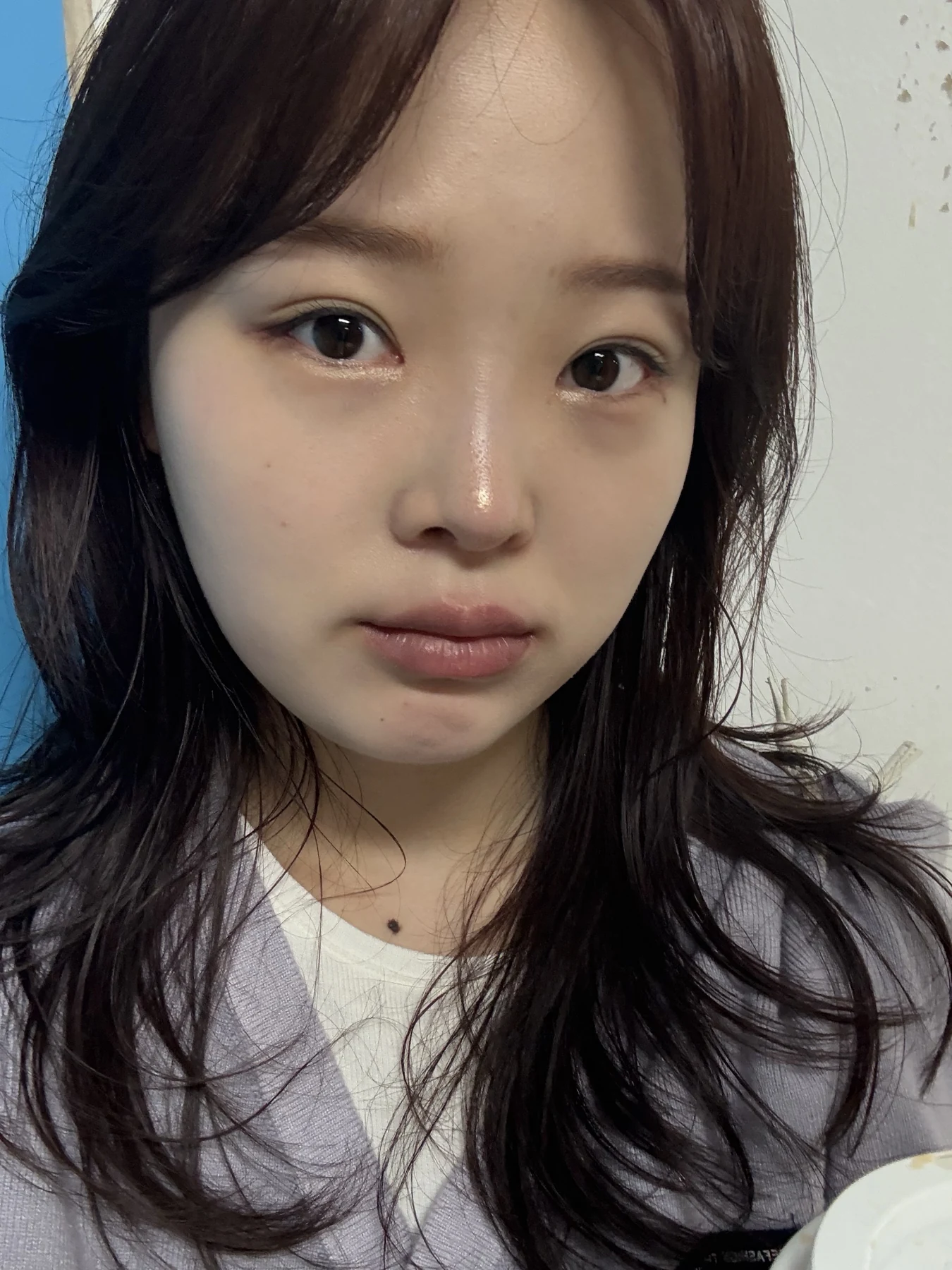 Eyelid and inner-corner surgery: six-month photo diary · Case 066 at Answer Plastic Surgery. Front-facing selfie — 3 months, eyelid and inner-corner surgery at Answer Plastic Surgery (case 066).