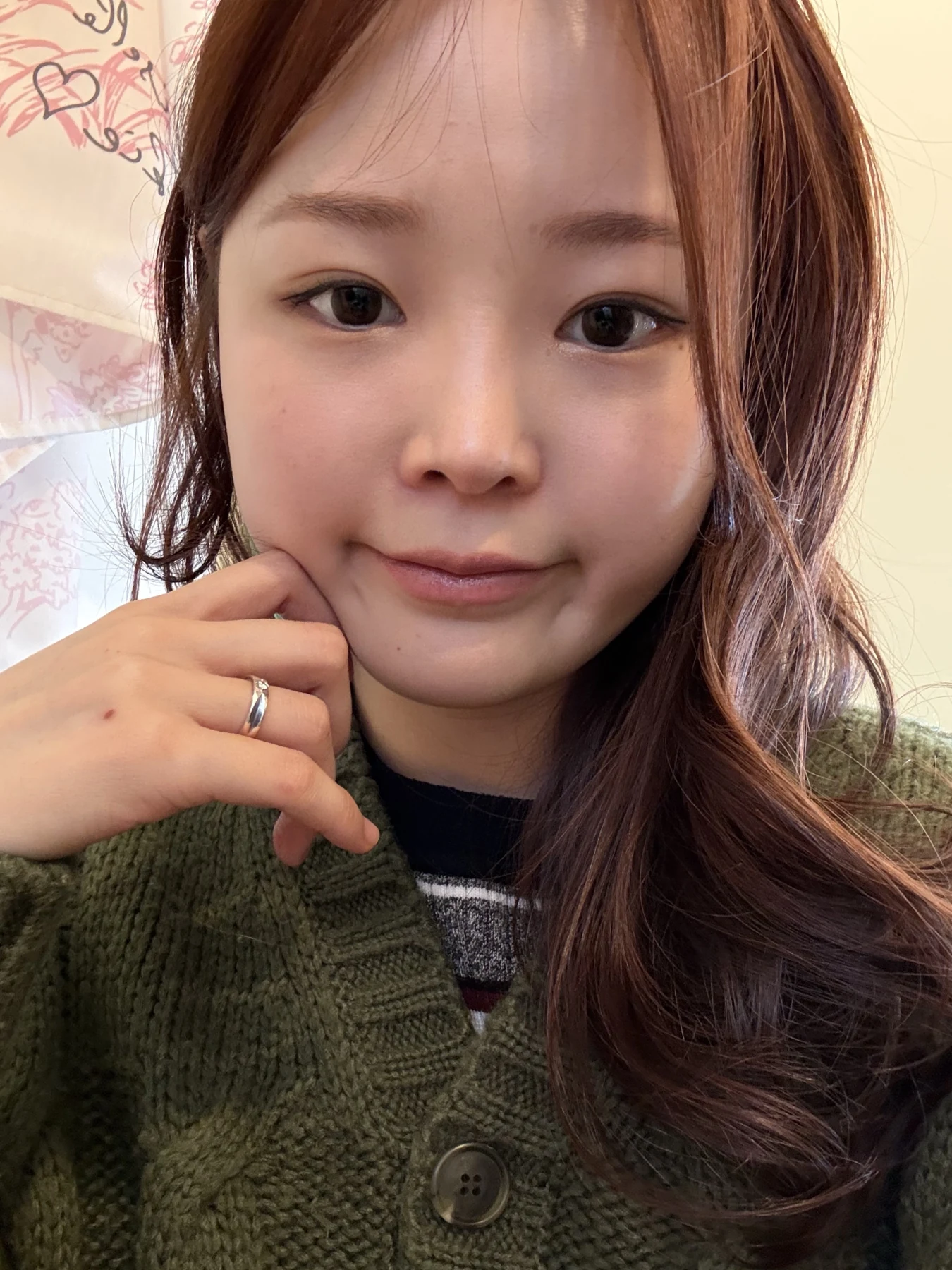 Eyelid and inner-corner surgery: six-month photo diary · Case 066 at Answer Plastic Surgery. Front-facing selfie — 6 months, eyelid and inner-corner surgery at Answer Plastic Surgery (case 066).