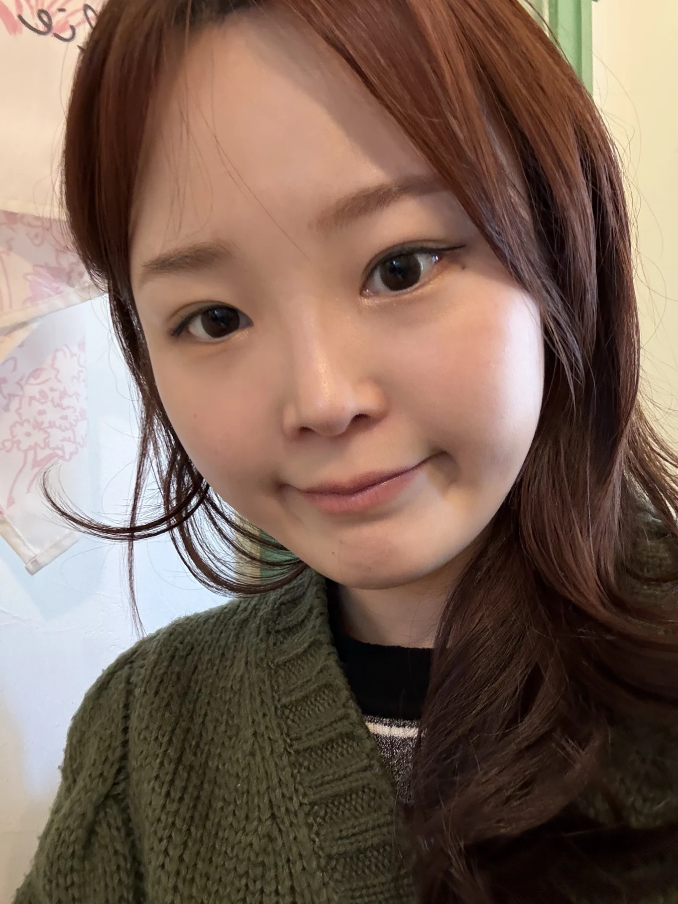 Eyelid and inner-corner surgery: six-month photo diary · Case 066 at Answer Plastic Surgery. Angled selfie — 6 months, eyelid and inner-corner surgery at Answer Plastic Surgery (case 066).