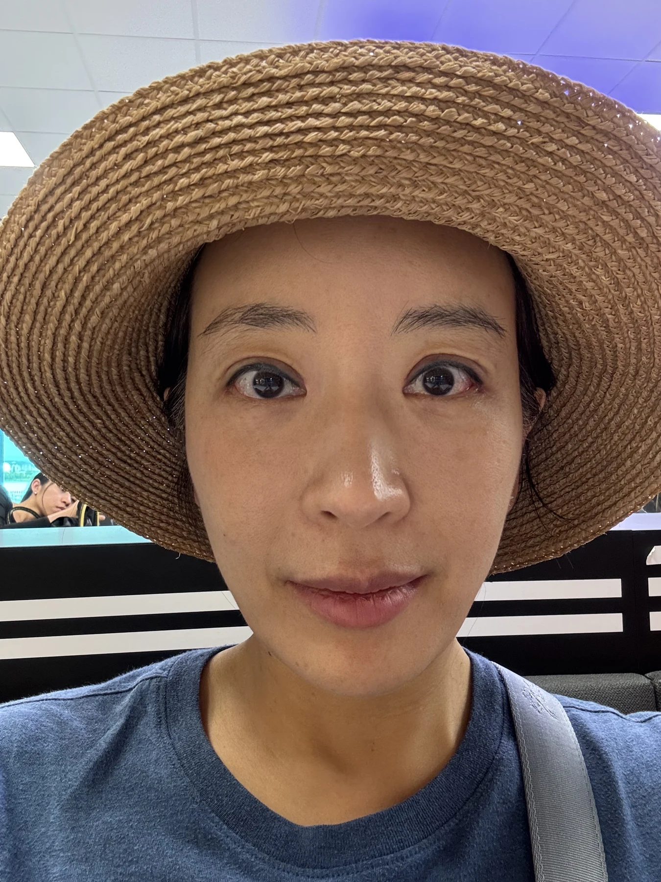 Wonder canthoplasty and eyelid correction: two-month diary · Case 068 at Answer Plastic Surgery. Front view — 3 weeks, wonder canthoplasty and eyelid correction at Answer Plastic Surgery (case 068).
