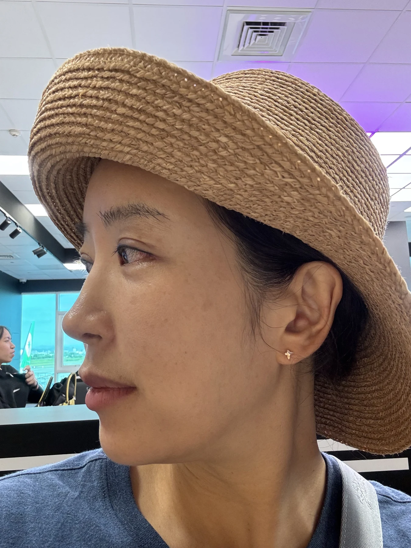 Wonder canthoplasty and eyelid correction: two-month diary · Case 068 at Answer Plastic Surgery. Angled view — 3 weeks, wonder canthoplasty and eyelid correction at Answer Plastic Surgery (case 068).