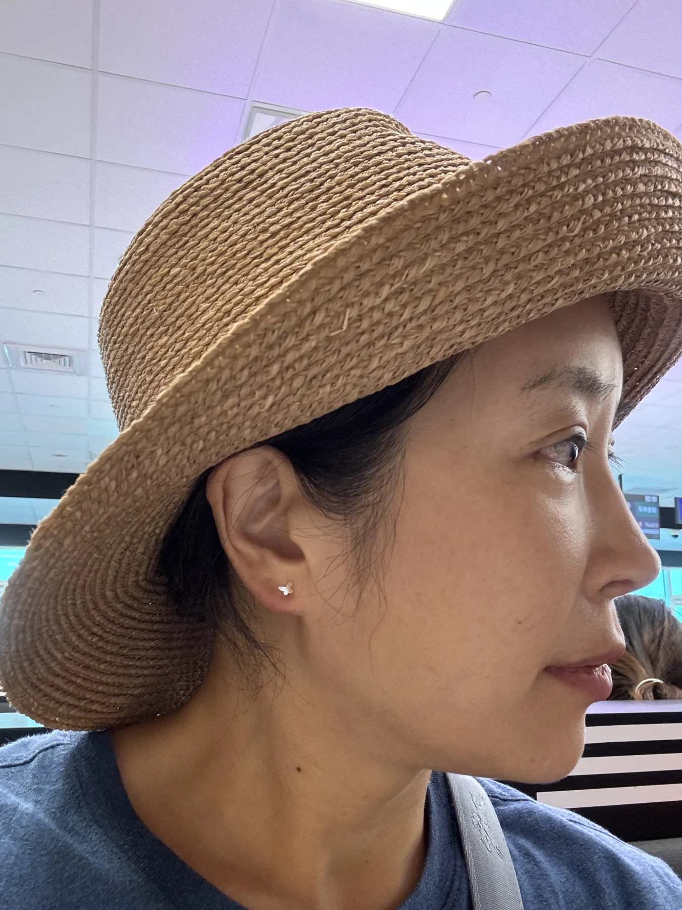 Wonder canthoplasty and eyelid correction: two-month diary · Case 068 at Answer Plastic Surgery. Additional angled view — 3 weeks, wonder canthoplasty and eyelid correction at Answer Plastic Surgery (case 068).