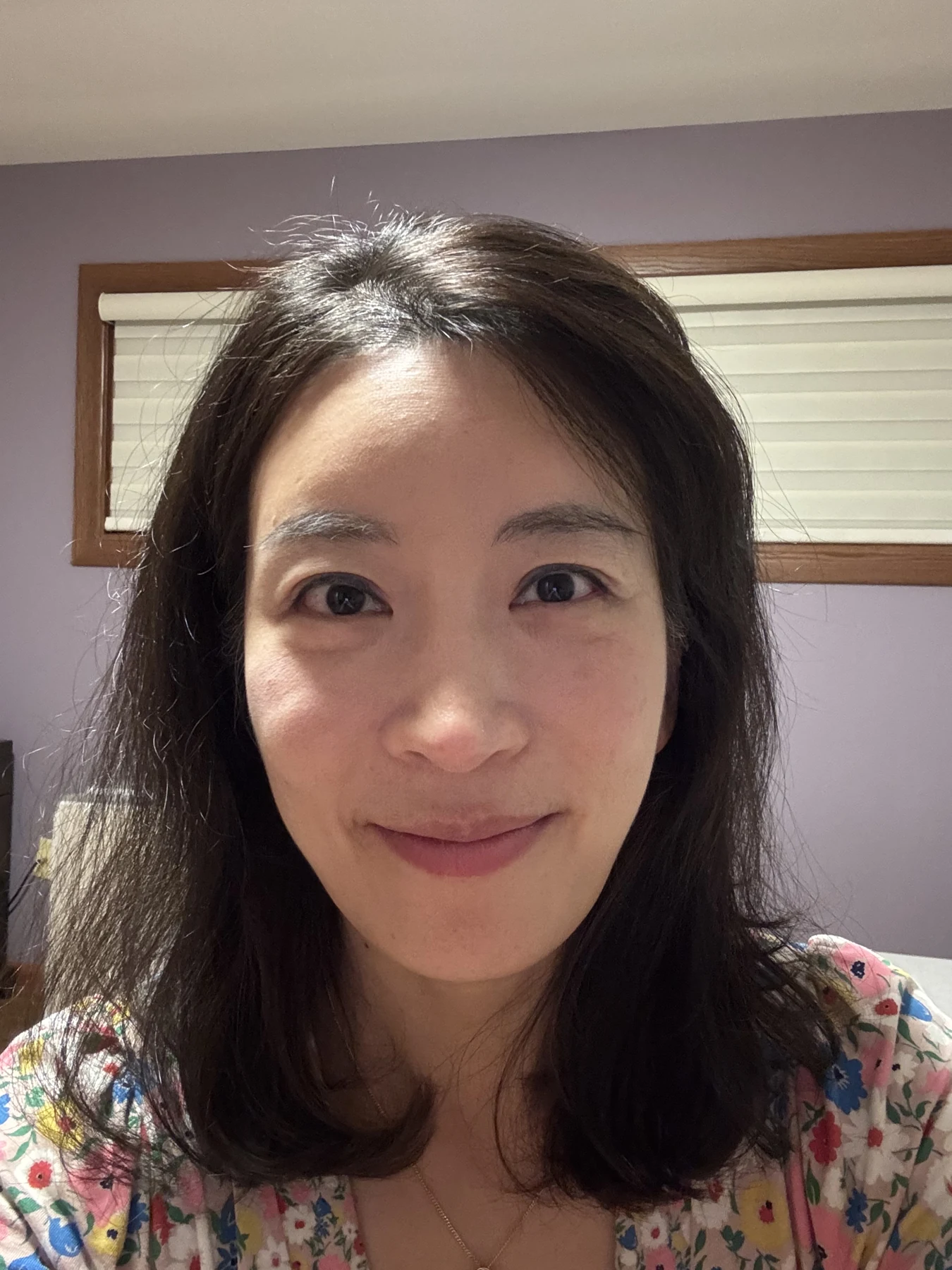 Wonder canthoplasty and eyelid correction: two-month diary · Case 068 at Answer Plastic Surgery. Front view — 2 months, wonder canthoplasty and eyelid correction at Answer Plastic Surgery (case 068).