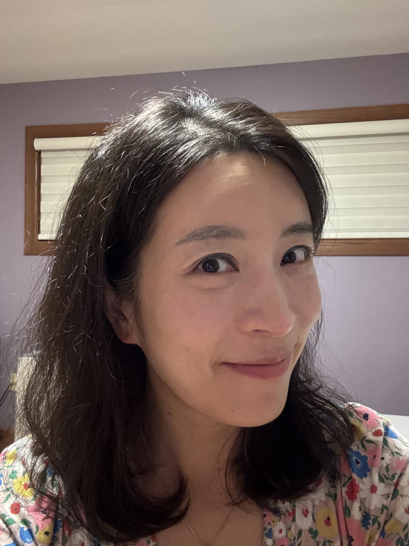 Wonder canthoplasty and eyelid correction: two-month diary · Case 068 at Answer Plastic Surgery. Angled view — 2 months, wonder canthoplasty and eyelid correction at Answer Plastic Surgery (case 068).