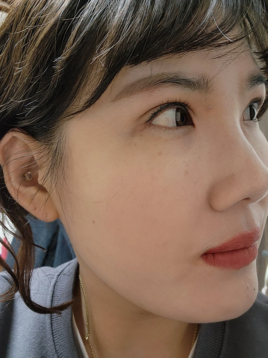 Revision inner-corner surgery and Wonder canthoplasty: six-month diary · Case 069 at Answer Plastic Surgery. Angled view — 3 months, revision inner-corner surgery and wonder canthoplasty at Answer Plastic Surgery (case 069).