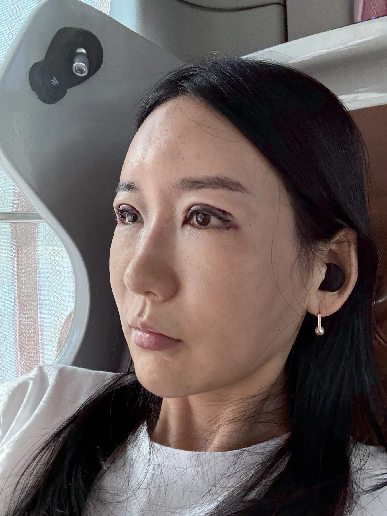 Incisional eyelid revision and eye-corner surgery: three-week recovery · Case 071 at Answer Plastic Surgery. Oblique view — surgery day, incisional eyelid revision and eye-corner surgery at Answer Plastic Surgery (case 071).