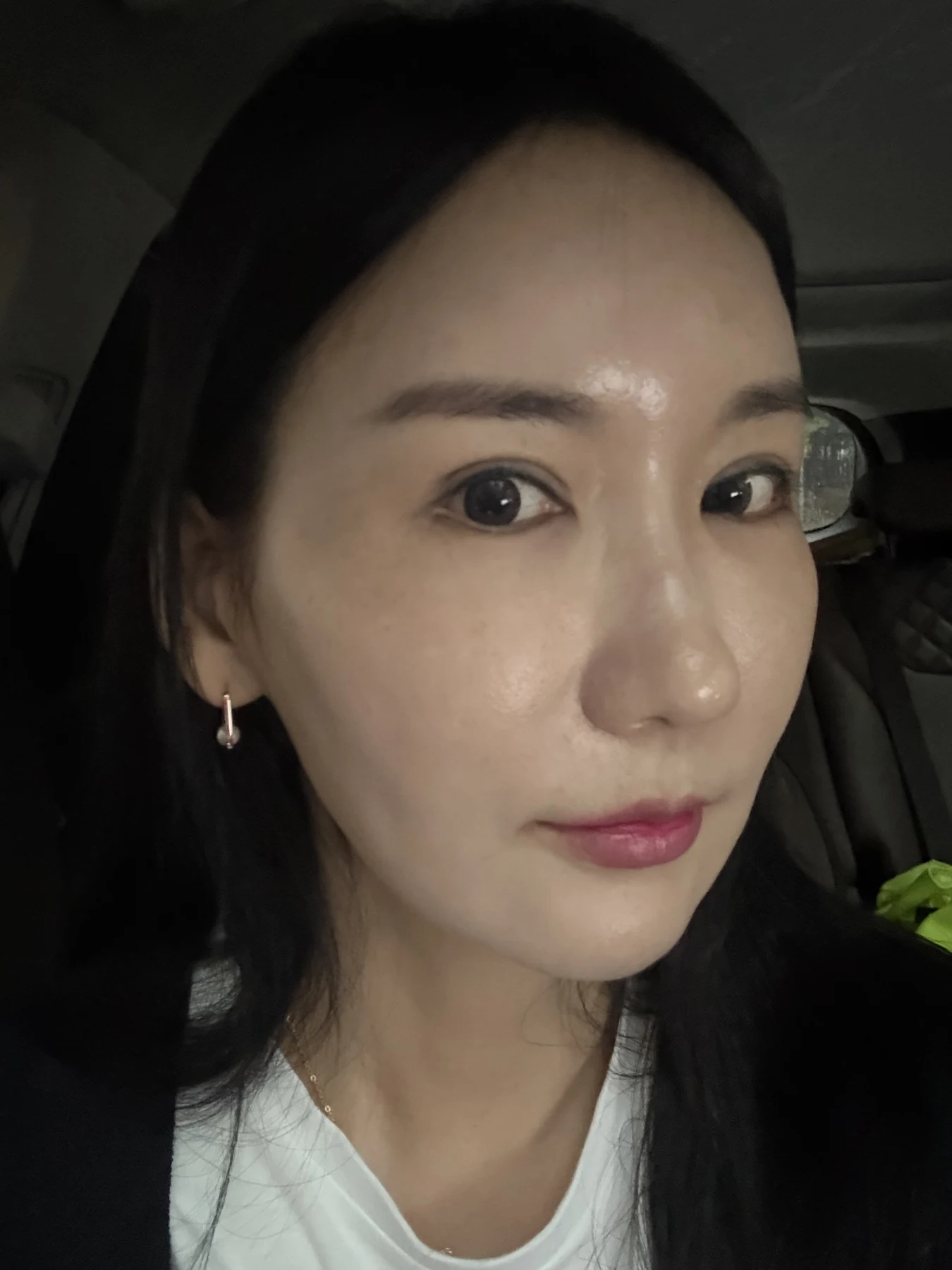Incisional eyelid revision and eye-corner surgery: three-week recovery · Case 071 at Answer Plastic Surgery. Oblique portrait — 3 weeks after surgery, incisional eyelid revision and eye-corner surgery at Answer Plastic Surgery (case 071).