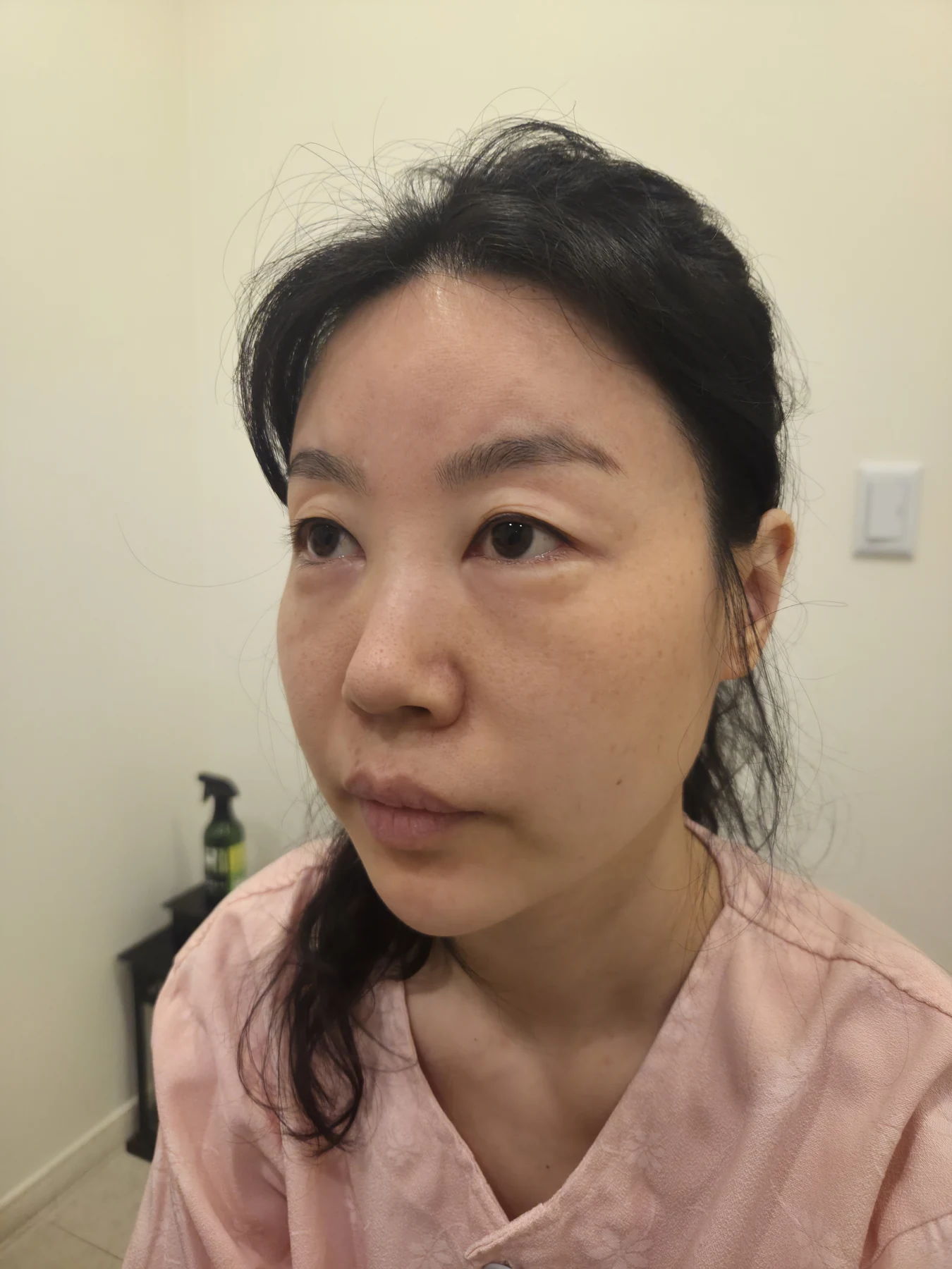 Double-eyelid and inner eye-corner surgery: a three-month photo diary · Case 074 at Answer Plastic Surgery. Oblique view facing image left — before surgery, double-eyelid and inner eye-corner surgery at Answer Plastic Surgery (case 074).