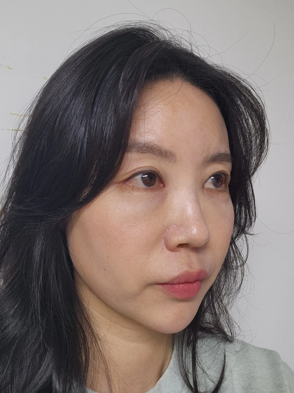 Double-eyelid and inner eye-corner surgery: a three-month photo diary · Case 074 at Answer Plastic Surgery. Oblique view facing image right — 1 month after surgery, double-eyelid and inner eye-corner surgery at Answer Plastic Surgery (case 074).