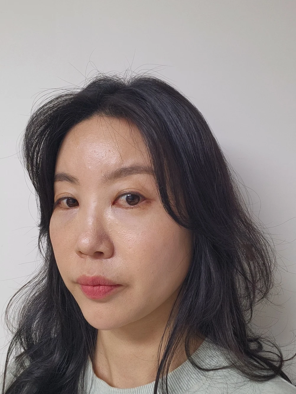 Double-eyelid and inner eye-corner surgery: a three-month photo diary · Case 074 at Answer Plastic Surgery. Oblique view facing image left — 1 month after surgery, double-eyelid and inner eye-corner surgery at Answer Plastic Surgery (case 074).