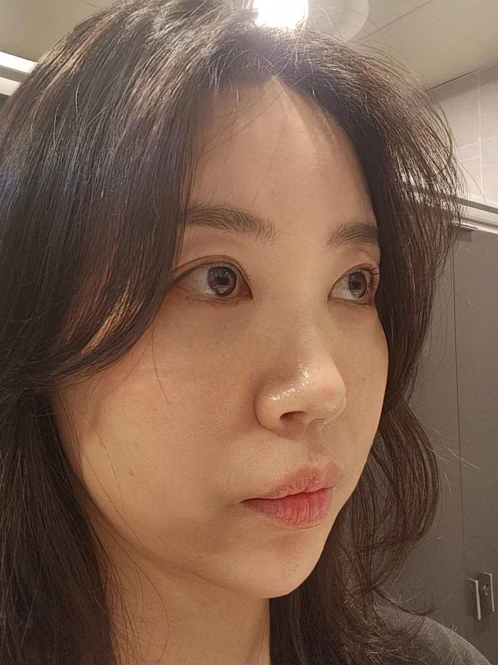 Double-eyelid and inner eye-corner surgery: a three-month photo diary · Case 074 at Answer Plastic Surgery. Oblique view facing image right — 2 months after surgery, double-eyelid and inner eye-corner surgery at Answer Plastic Surgery (case 074).