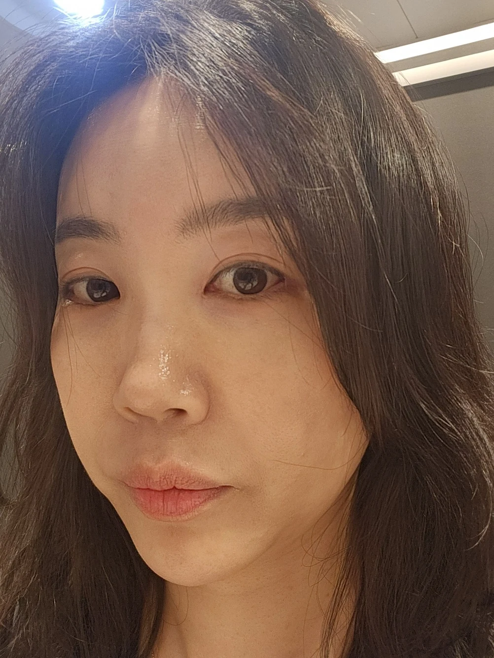 Double-eyelid and inner eye-corner surgery: a three-month photo diary · Case 074 at Answer Plastic Surgery. Oblique view facing image left — 2 months after surgery, double-eyelid and inner eye-corner surgery at Answer Plastic Surgery (case 074).
