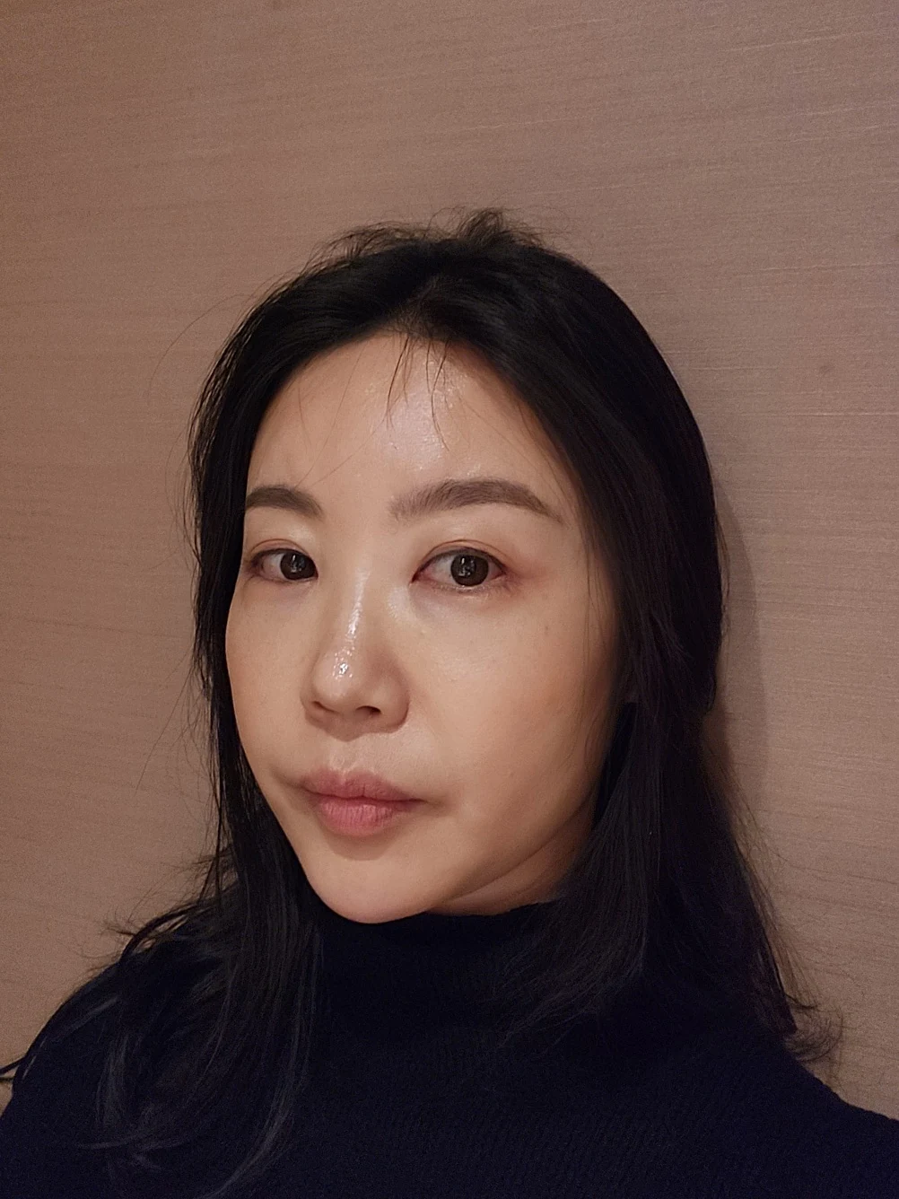 Double-eyelid and inner eye-corner surgery: a three-month photo diary · Case 074 at Answer Plastic Surgery. Oblique view facing image left — 3 months after surgery, double-eyelid and inner eye-corner surgery at Answer Plastic Surgery (case 074).