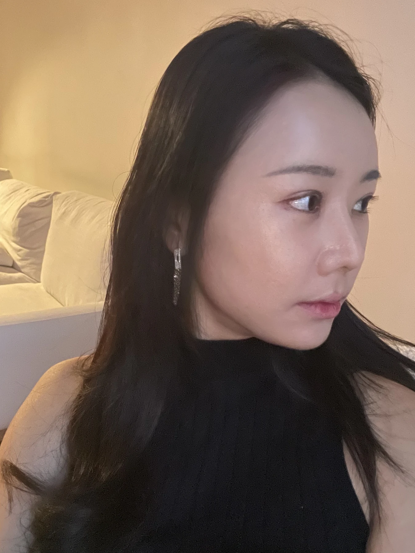 Eye-area surgery: photographs through one month · Case 081 at Answer Plastic Surgery. Opposite oblique view — 1 month after surgery, eye-area surgery at Answer Plastic Surgery (case 081).