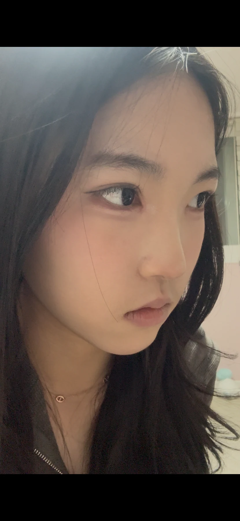 Eyelid surgery: photographs from surgery day to three months · Case 082 at Answer Plastic Surgery. Oblique view — 3 weeks after surgery, eyelid surgery at Answer Plastic Surgery (case 082).