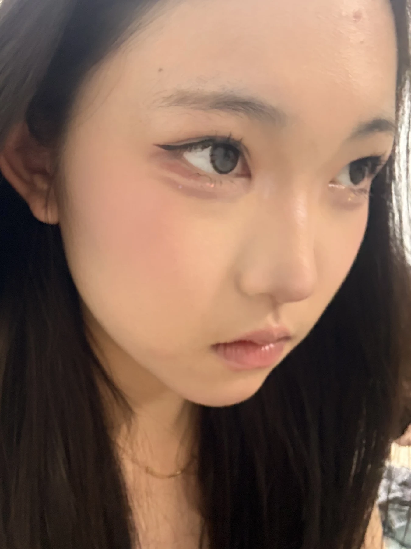 Eyelid surgery: photographs from surgery day to three months · Case 082 at Answer Plastic Surgery. Oblique view — 3 months after surgery, eyelid surgery at Answer Plastic Surgery (case 082).