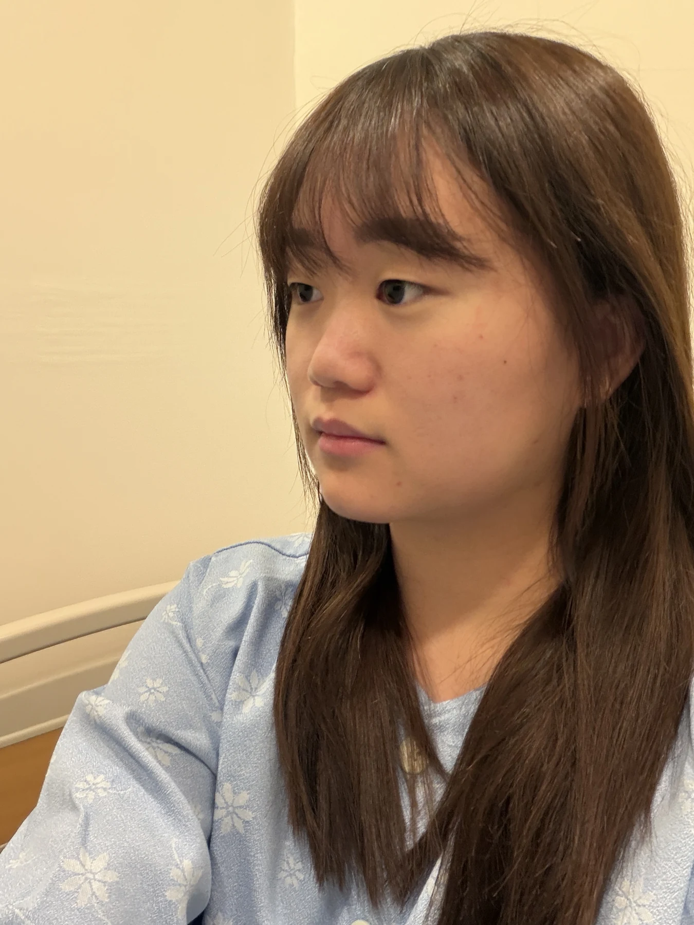 Eye-area surgery: three-month photo timeline · Case 083 at Answer Plastic Surgery. Oblique view — before, eye-area surgery at Answer Plastic Surgery (case 083).