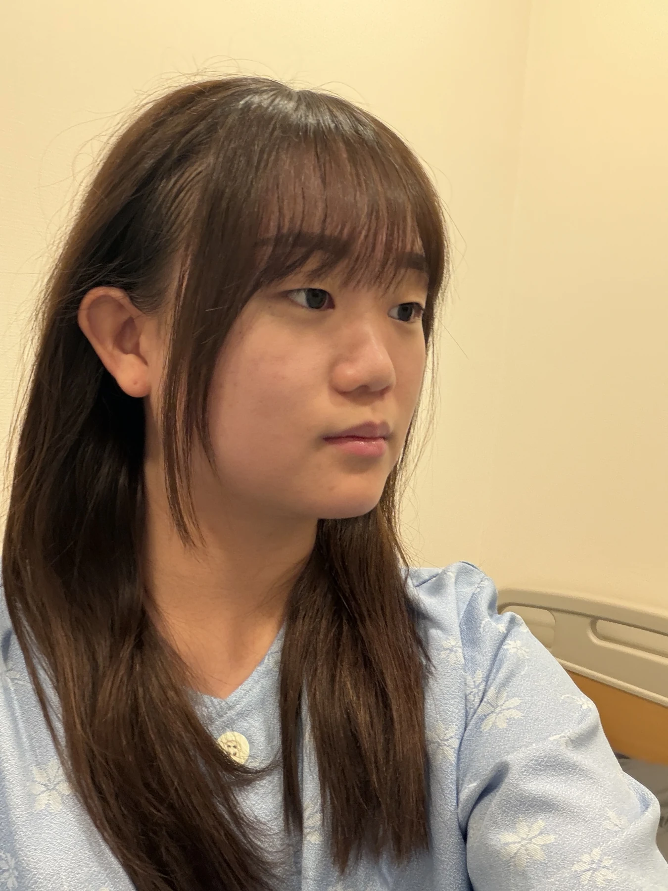 Eye-area surgery: three-month photo timeline · Case 083 at Answer Plastic Surgery. Opposite oblique view — before, eye-area surgery at Answer Plastic Surgery (case 083).