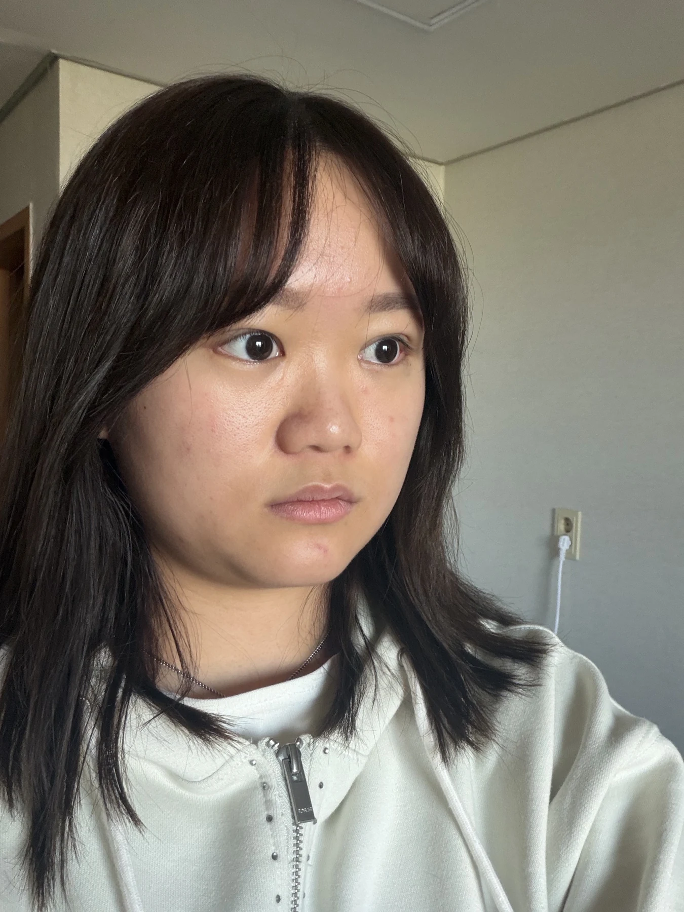 Eye-area surgery: three-month photo timeline · Case 083 at Answer Plastic Surgery. Opposite oblique view — 1 month after surgery, eye-area surgery at Answer Plastic Surgery (case 083).