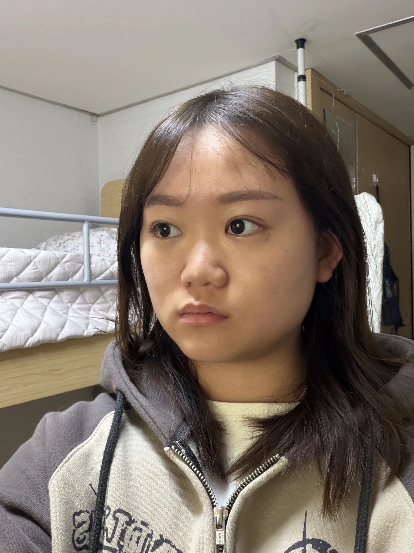 Eye-area surgery: three-month photo timeline · Case 083 at Answer Plastic Surgery. Opposite oblique view — 2 months after surgery, eye-area surgery at Answer Plastic Surgery (case 083).