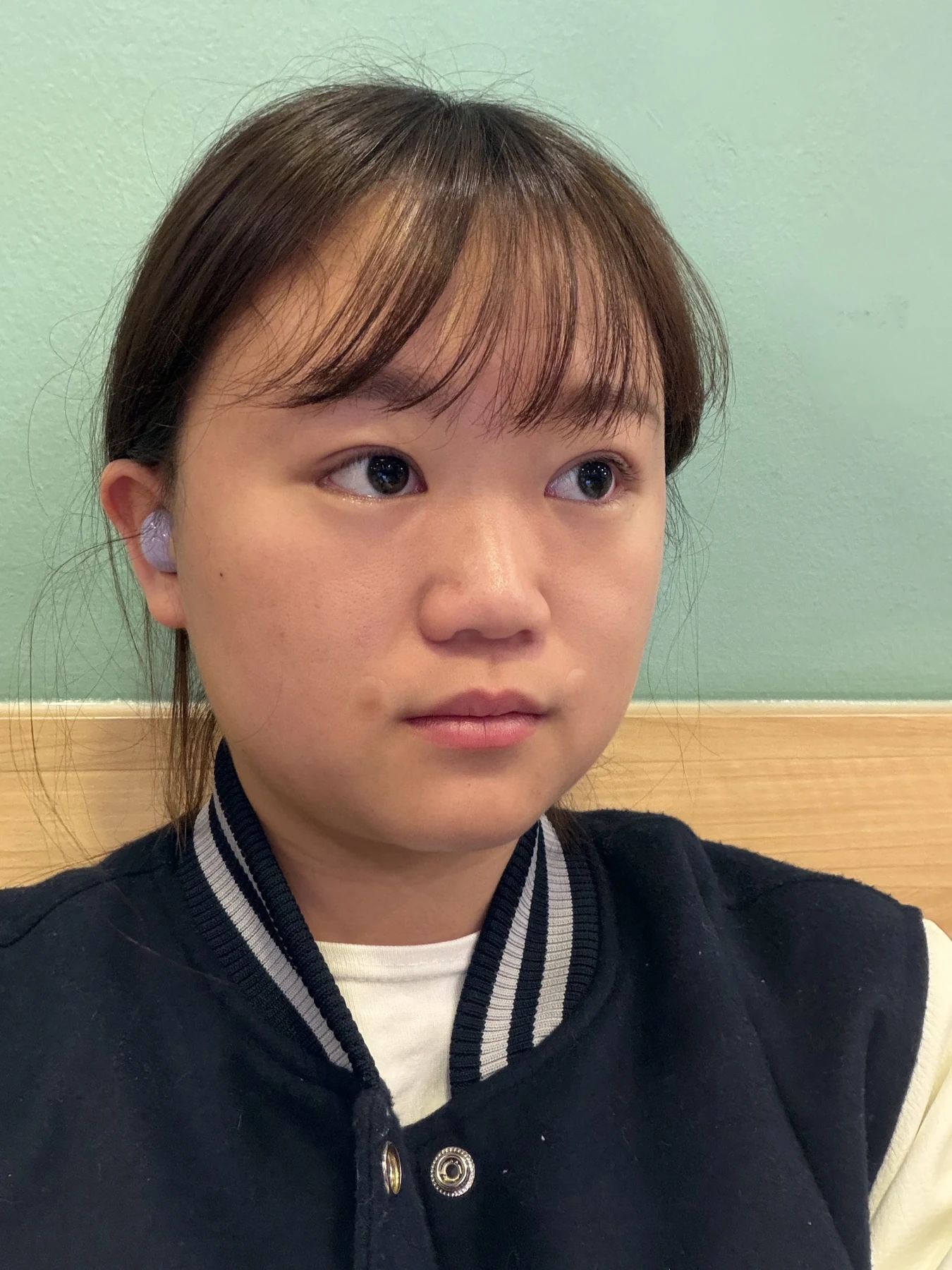 Eye-area surgery: three-month photo timeline · Case 083 at Answer Plastic Surgery. Oblique view — 3 months after surgery, eye-area surgery at Answer Plastic Surgery (case 083).