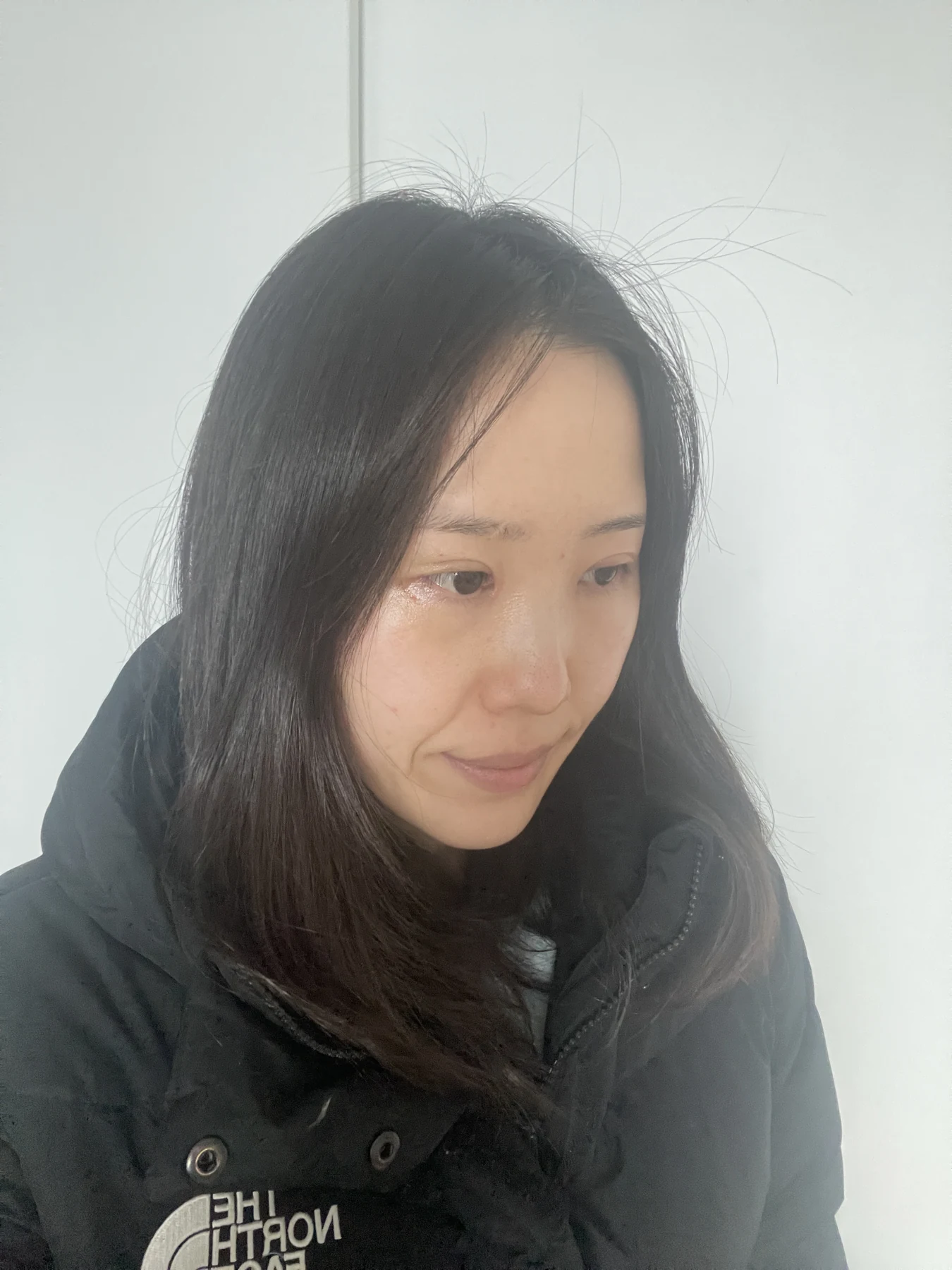 Eye-area surgery for a drooping-eyelid concern: six-month photographs · Case 084 at Answer Plastic Surgery. Oblique view — 2 weeks after surgery, eye-area surgery for a drooping-eyelid concern at Answer Plastic Surgery (case 084).