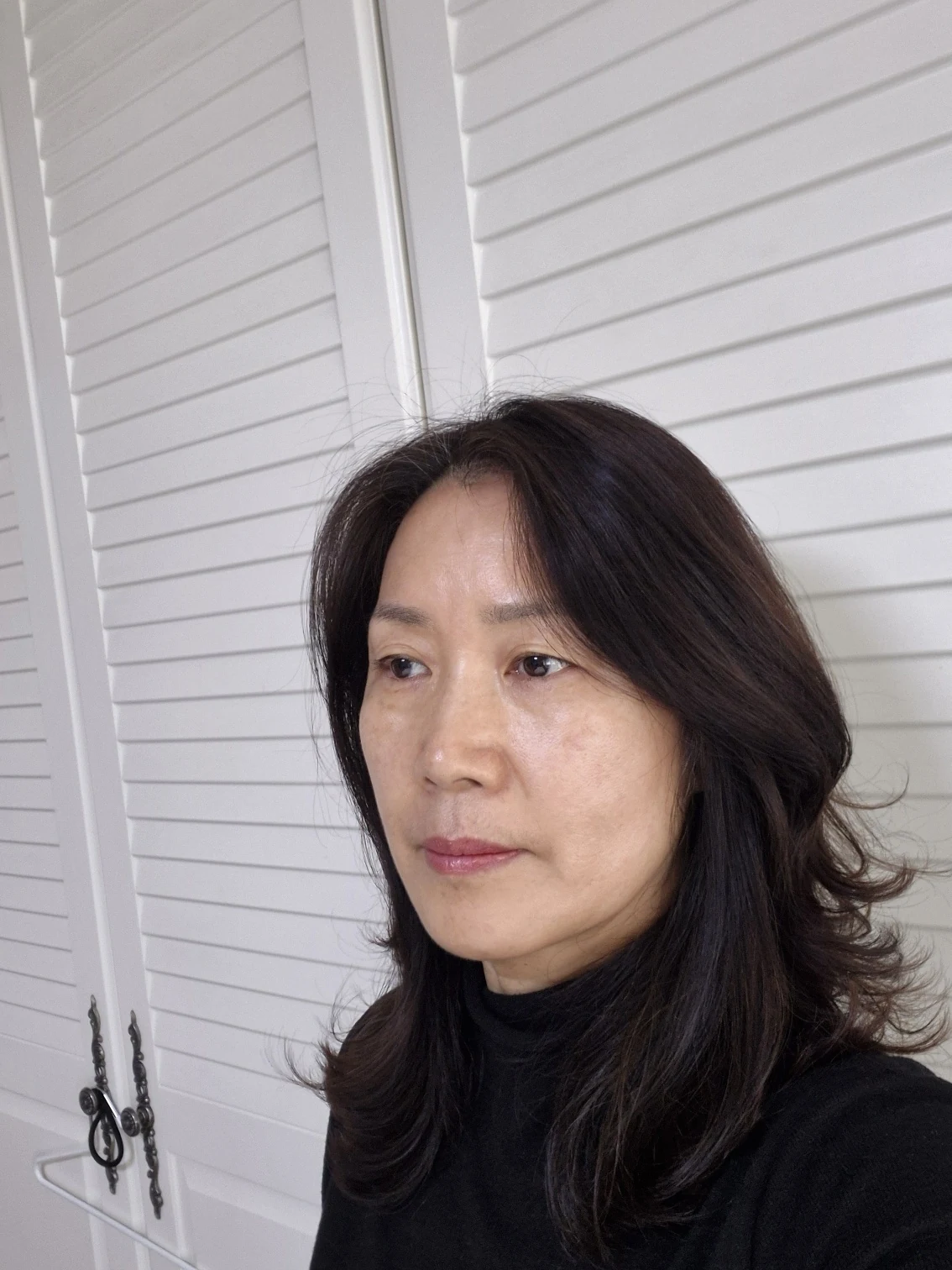 Sub-brow lift: recovery photographs through six months · Case 086 at Answer Plastic Surgery. Opposite oblique view — before, sub-brow lift at Answer Plastic Surgery (case 086).