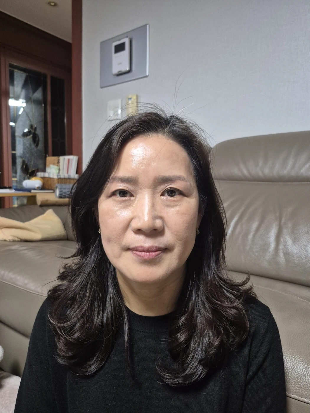 Sub-brow lift: recovery photographs through six months · Case 086 at Answer Plastic Surgery. Front view — 2 months after surgery, sub-brow lift at Answer Plastic Surgery (case 086).