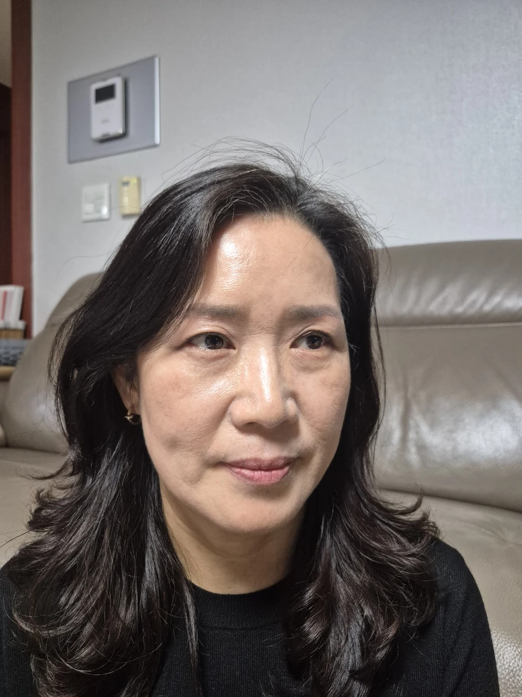 Sub-brow lift: recovery photographs through six months · Case 086 at Answer Plastic Surgery. Oblique view — 2 months after surgery, sub-brow lift at Answer Plastic Surgery (case 086).