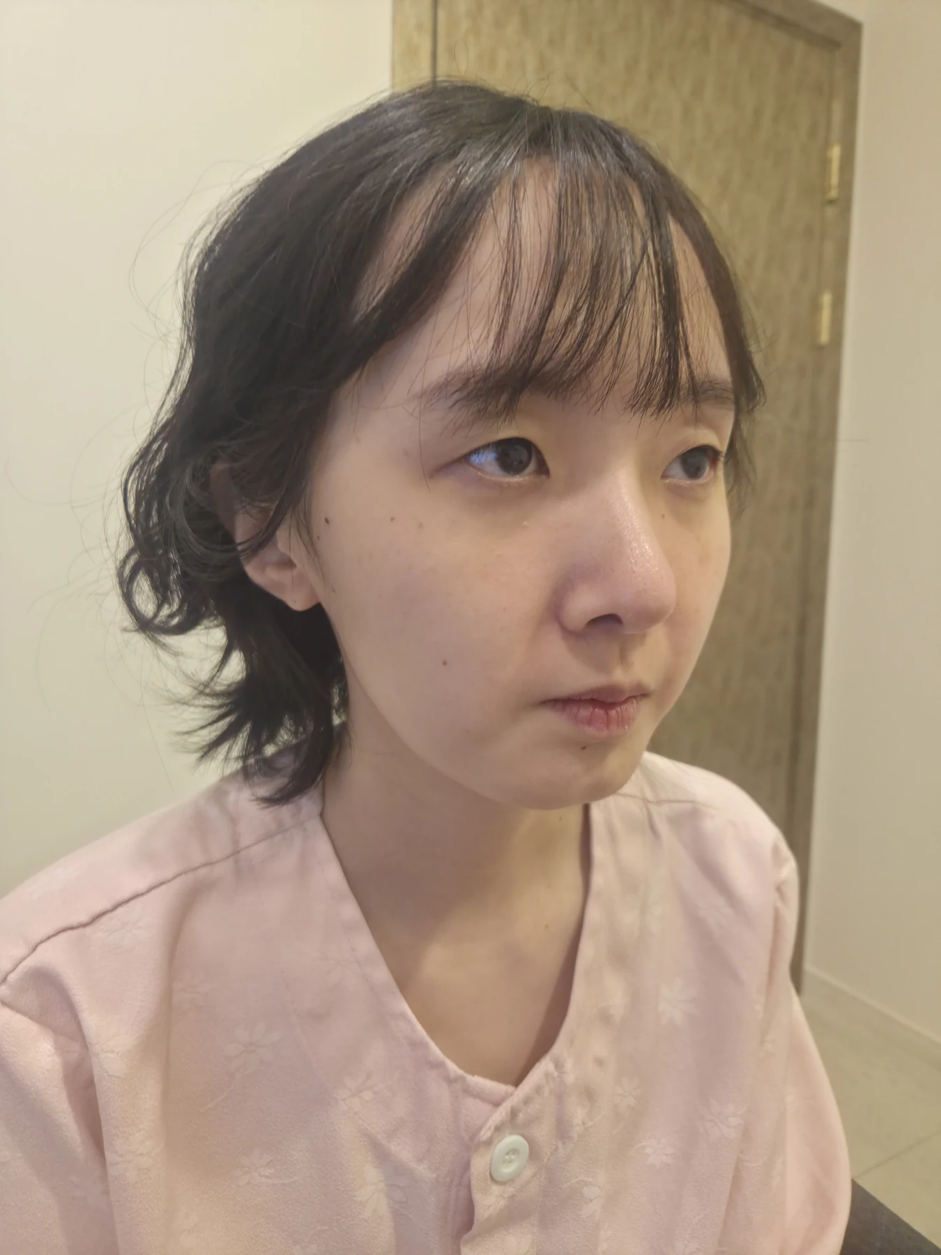 Eyelid surgery: three-month recovery and an asymmetry concern · Case 087 at Answer Plastic Surgery. Oblique view — before, eyelid surgery at Answer Plastic Surgery (case 087).