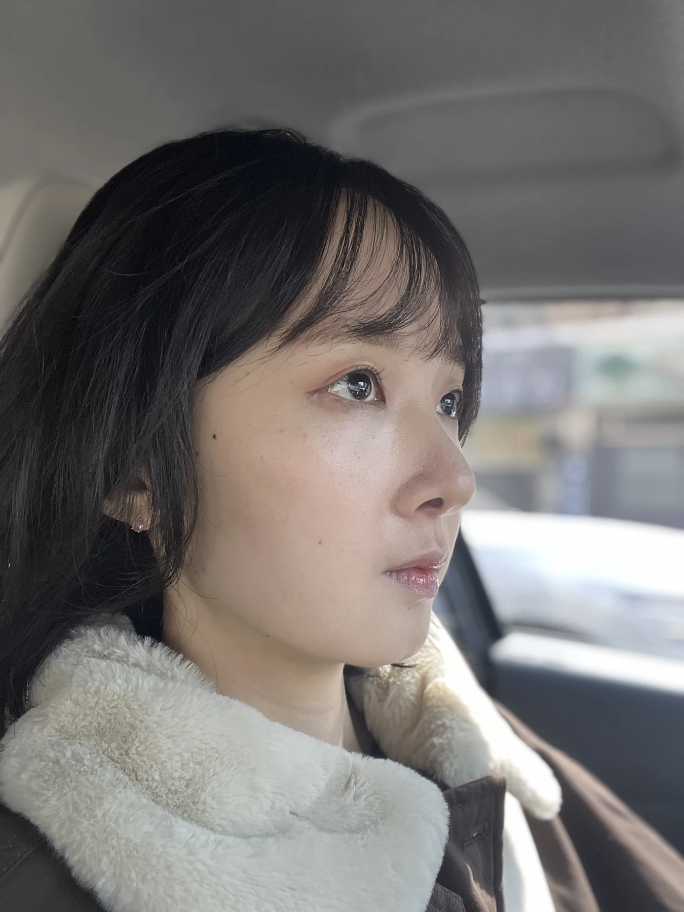 Eyelid surgery: three-month recovery and an asymmetry concern · Case 087 at Answer Plastic Surgery. Oblique view — 1 month after surgery, eyelid surgery at Answer Plastic Surgery (case 087).